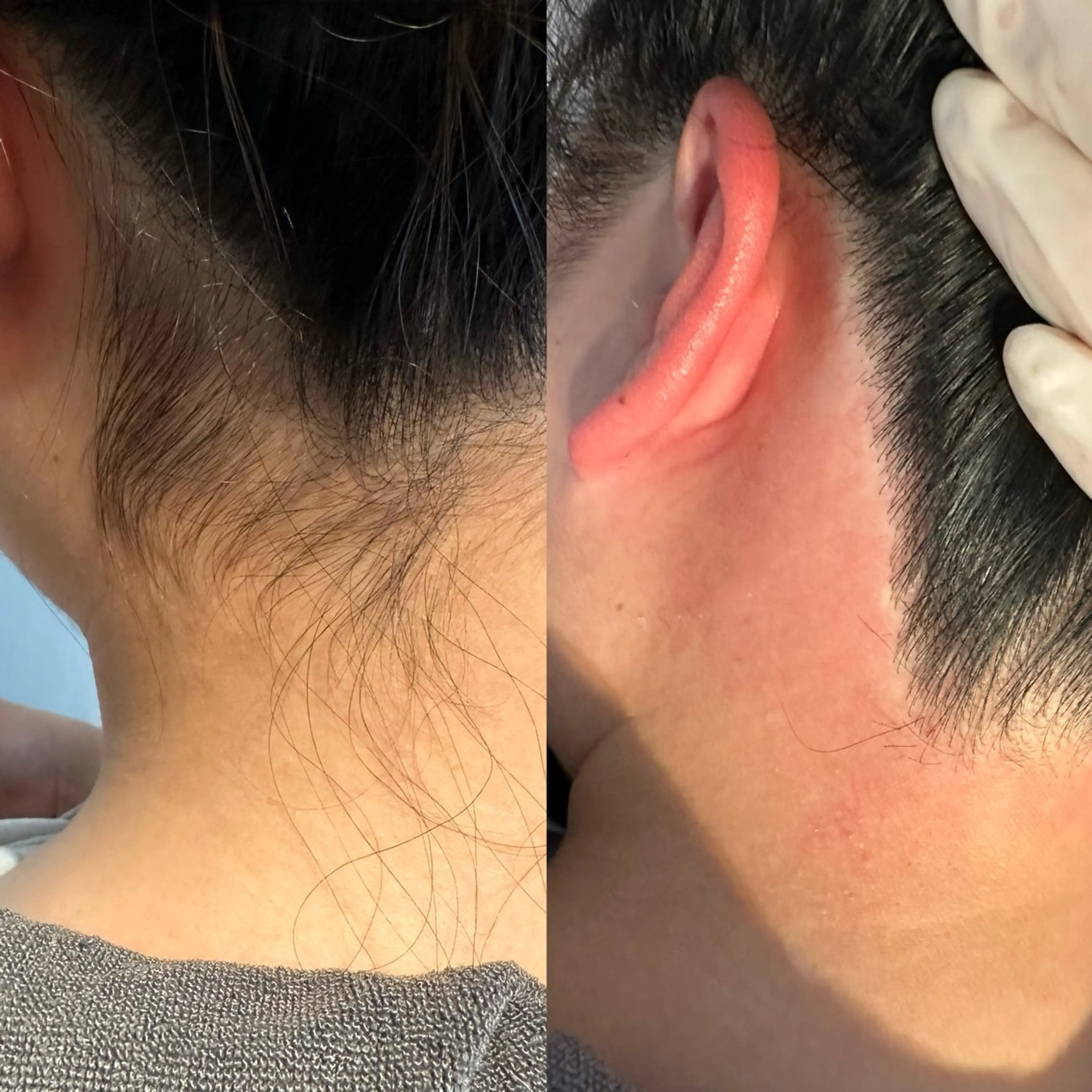 頭皮・薄毛改善サロン ｜眉毛｜痩身のエステ・リラクイメージ