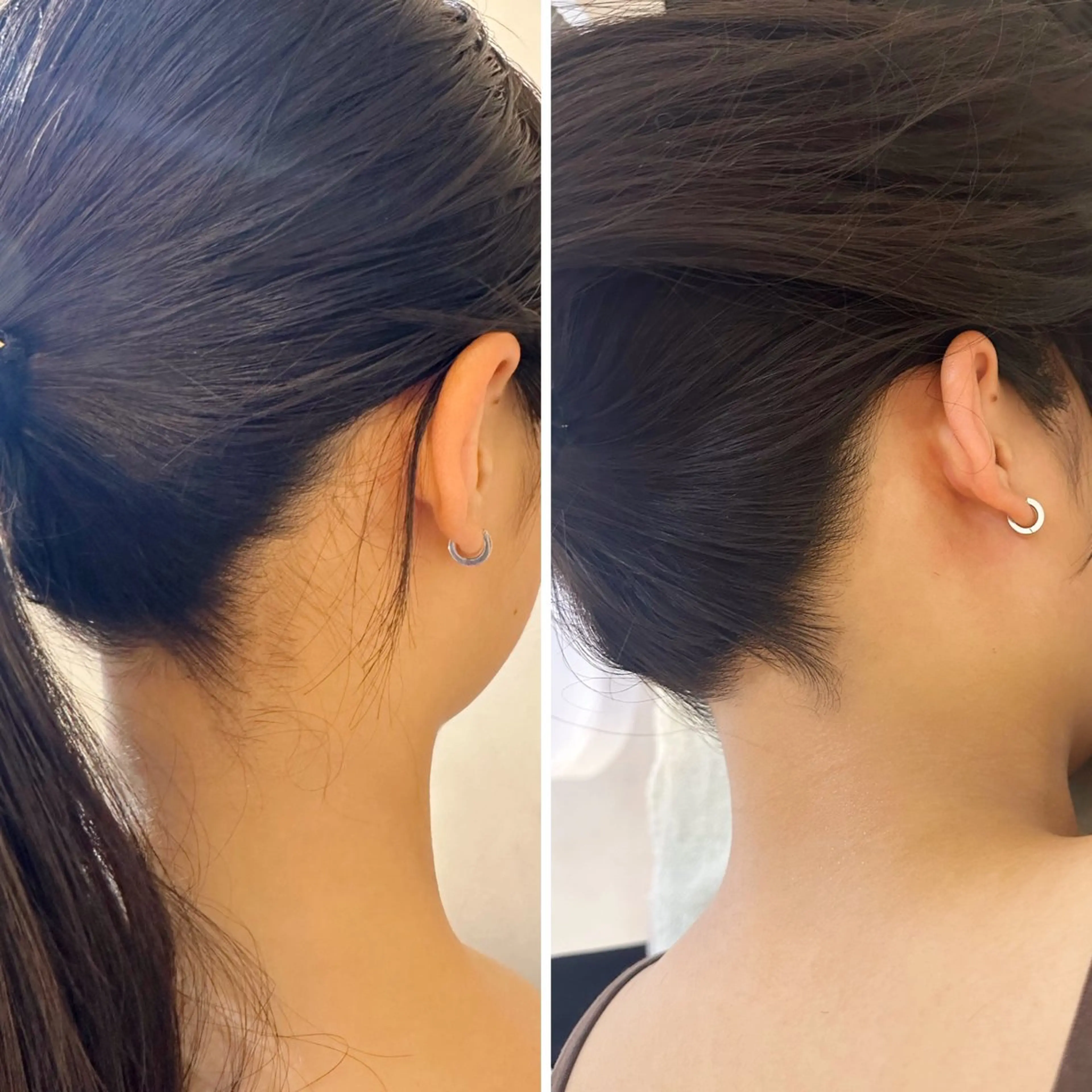 脱毛 うなじ脱毛/美肌脱毛 LABELのエステ・リラクイメージ