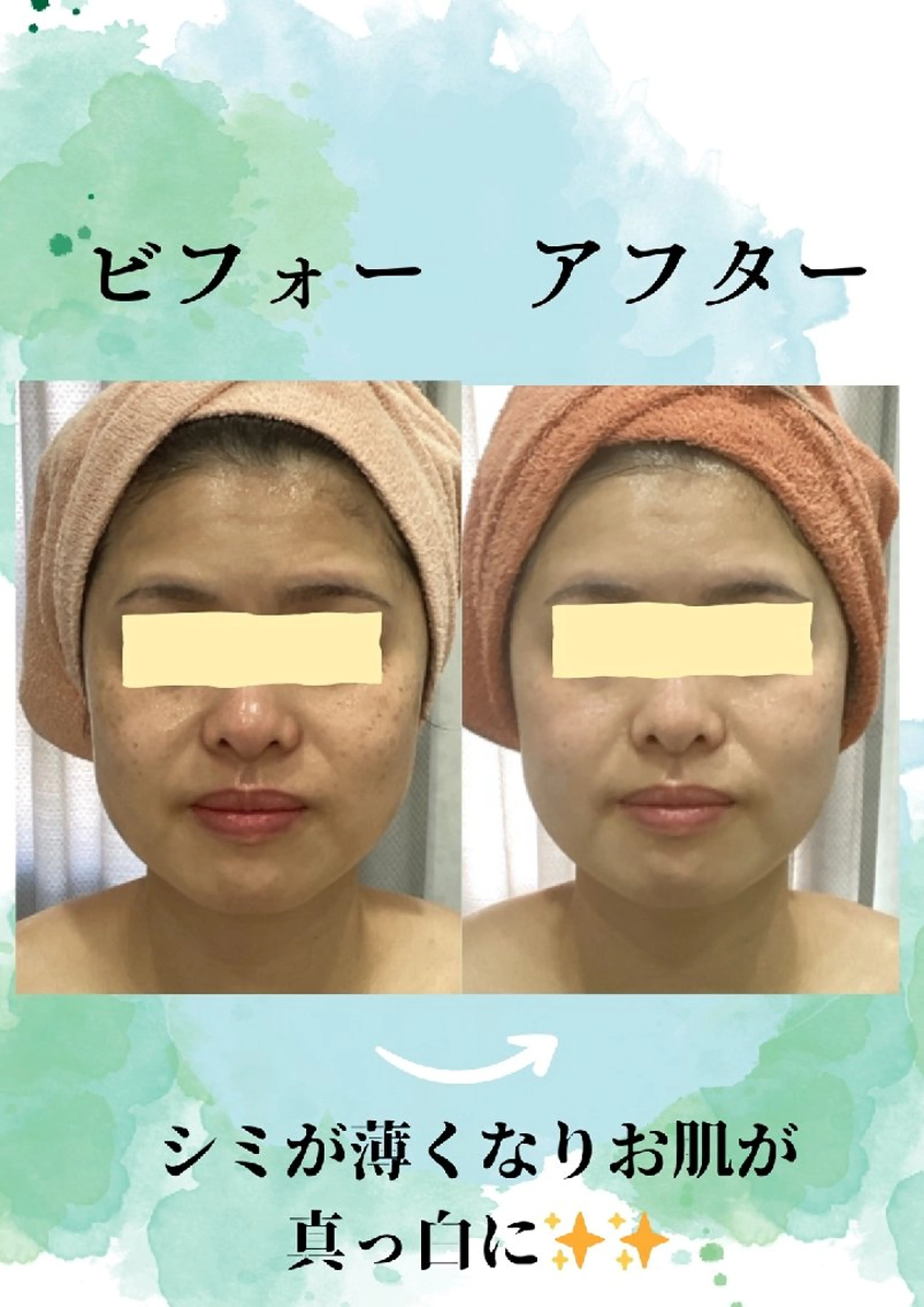 エステ エステ♡ Eden Yuriのエステ・リラクイメージ