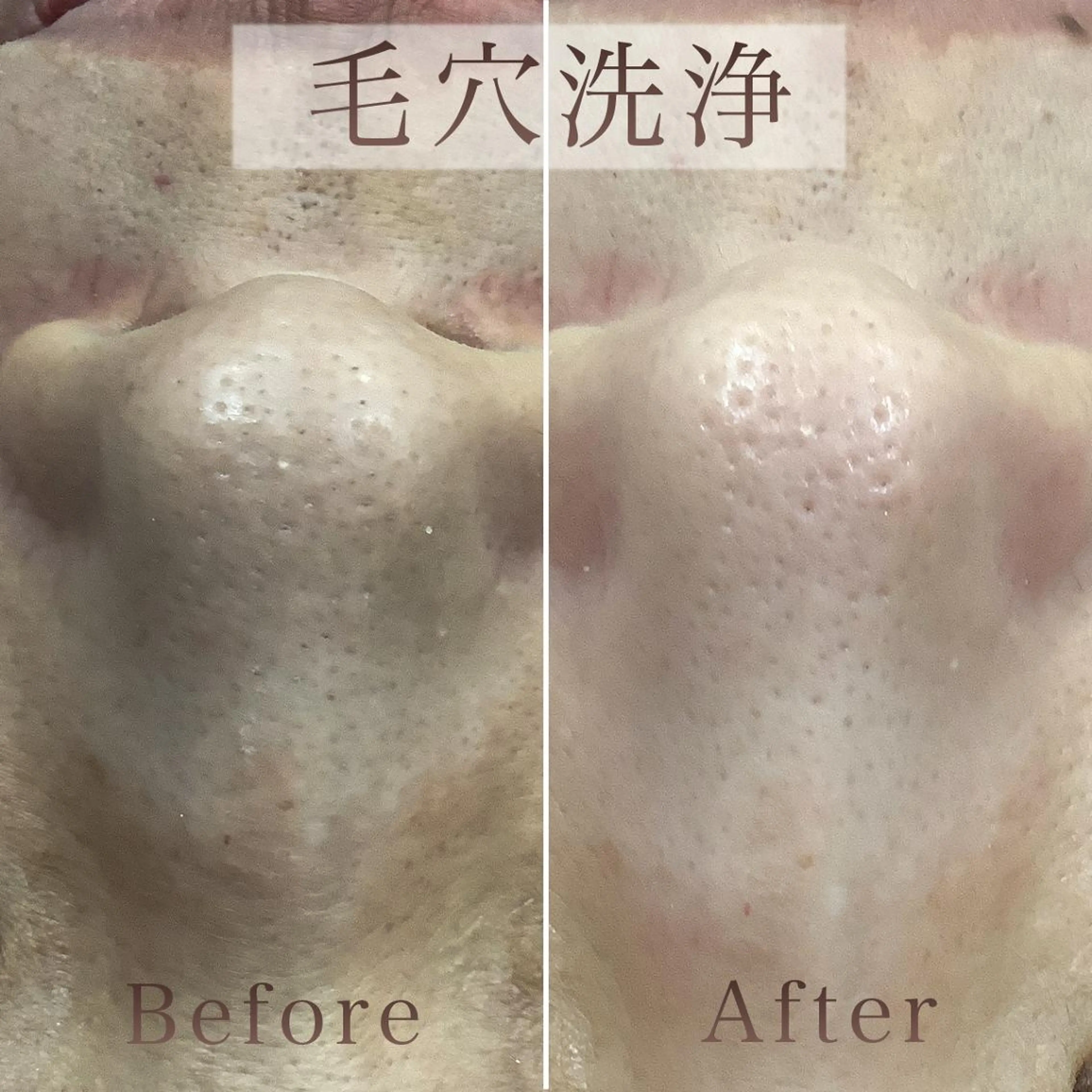 エステ リラク 【毛穴洗浄・小顔】 セラピスト　和田紋子のエステ・リラクイメージ