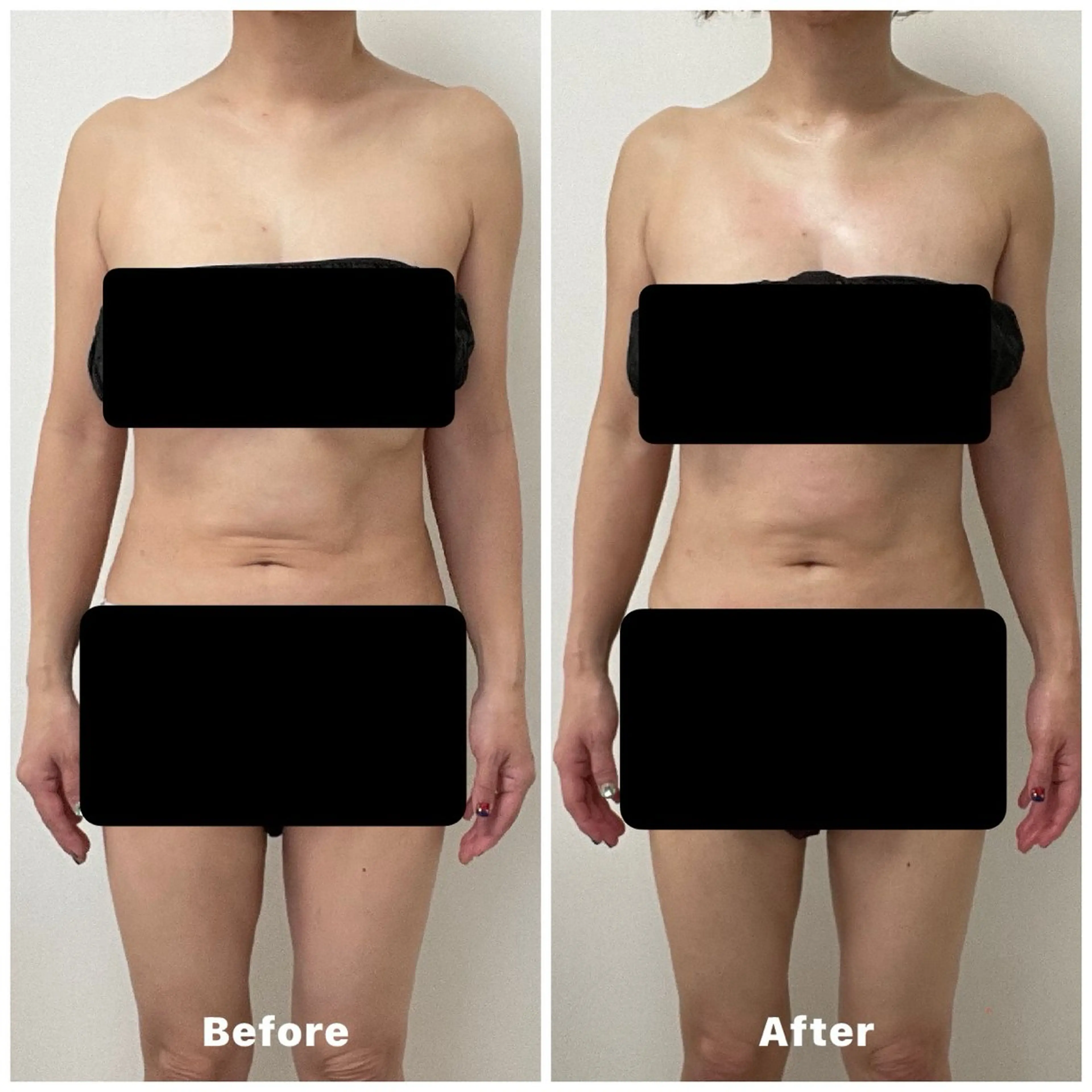 エステ リラク 心と体が整う腸活 サロン ラクシュミーのエステ・リラクイメージ