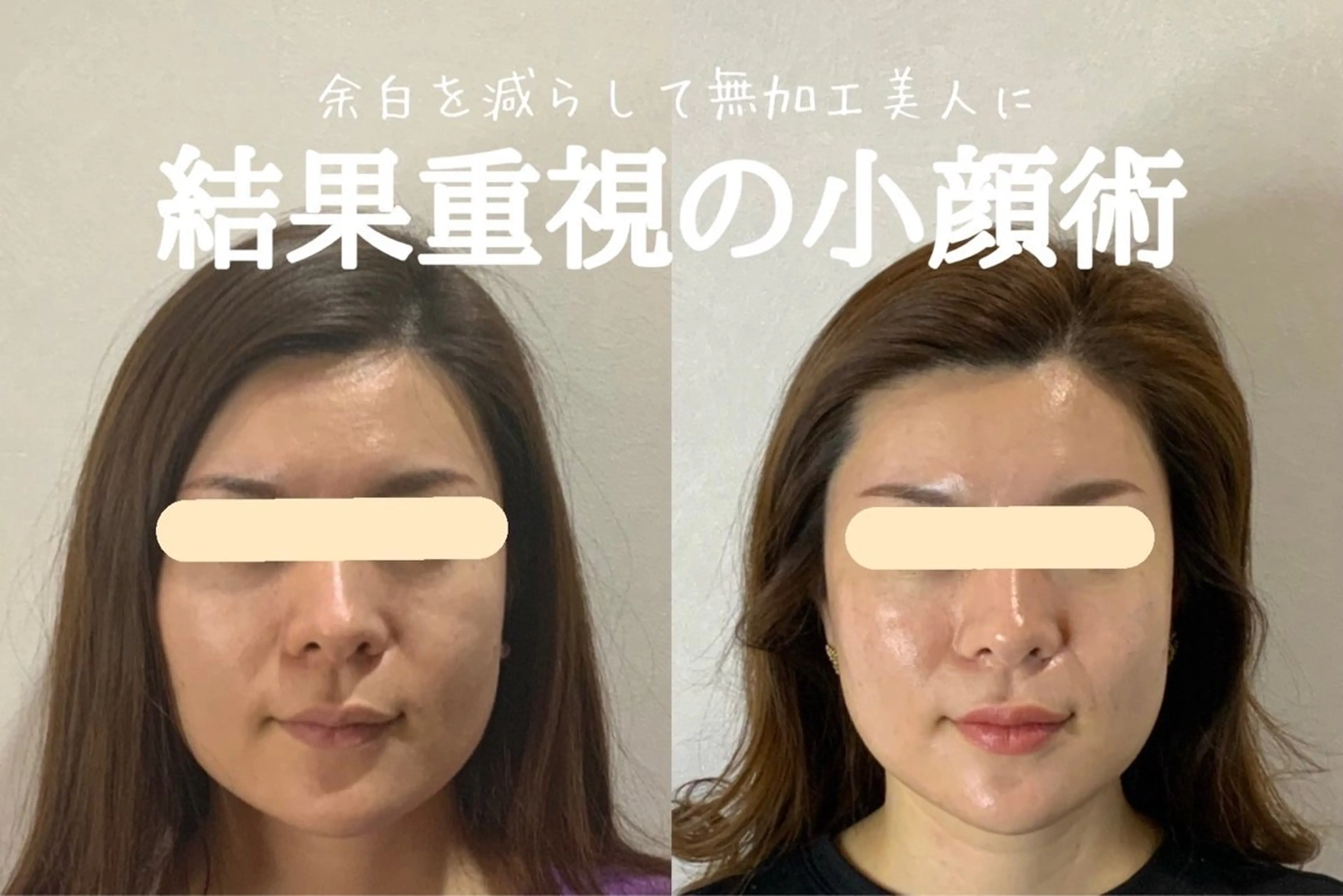 エステ リラク 最速小顔・肌質管理 espoirマキのエステ・リラクイメージ