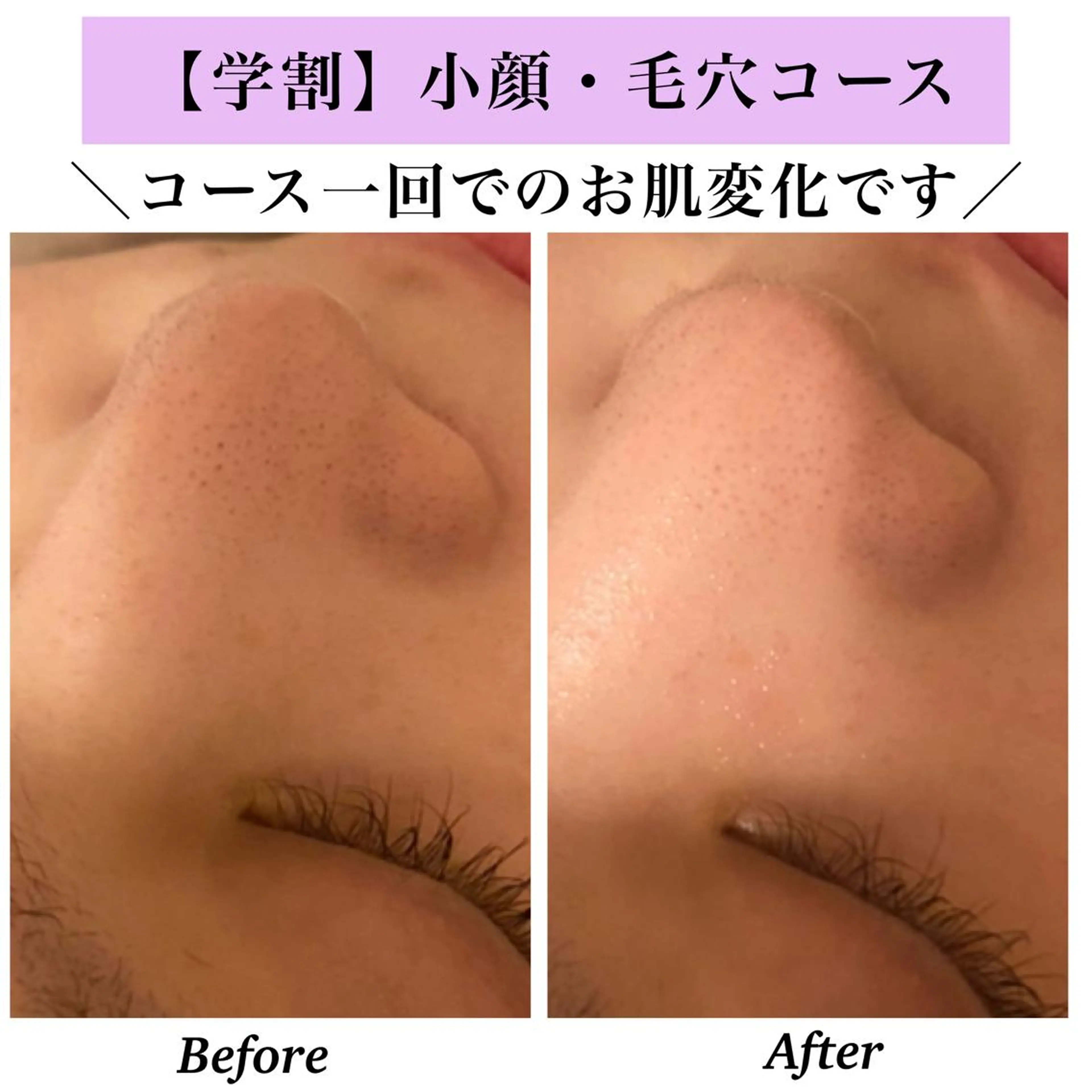 Bellesthe (ベルエステ)のエステ・リラクイメージ