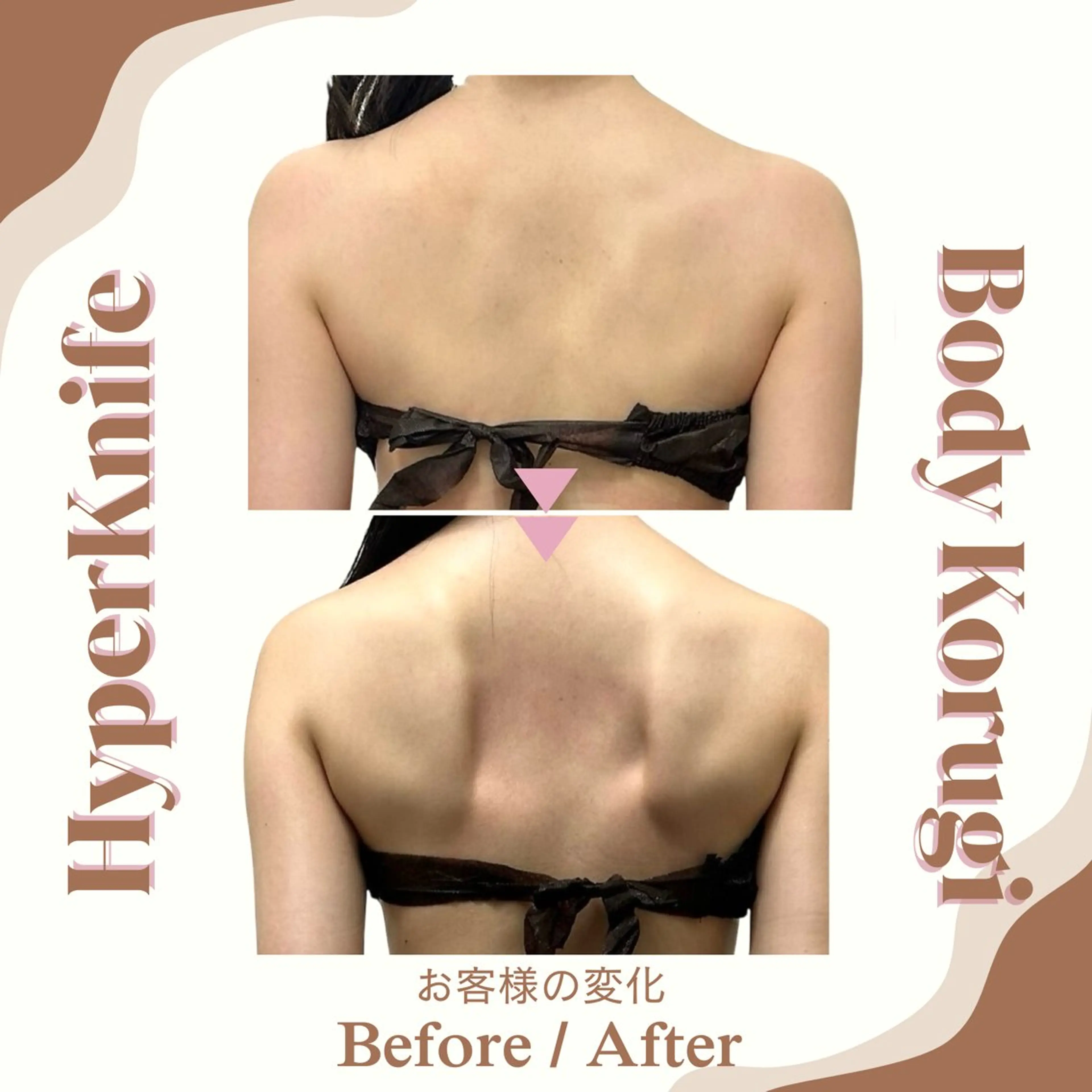 《ミニモ学割》U24 デコルテ&肩甲骨ケア|ハイパーナイフ×コルギ|の写真