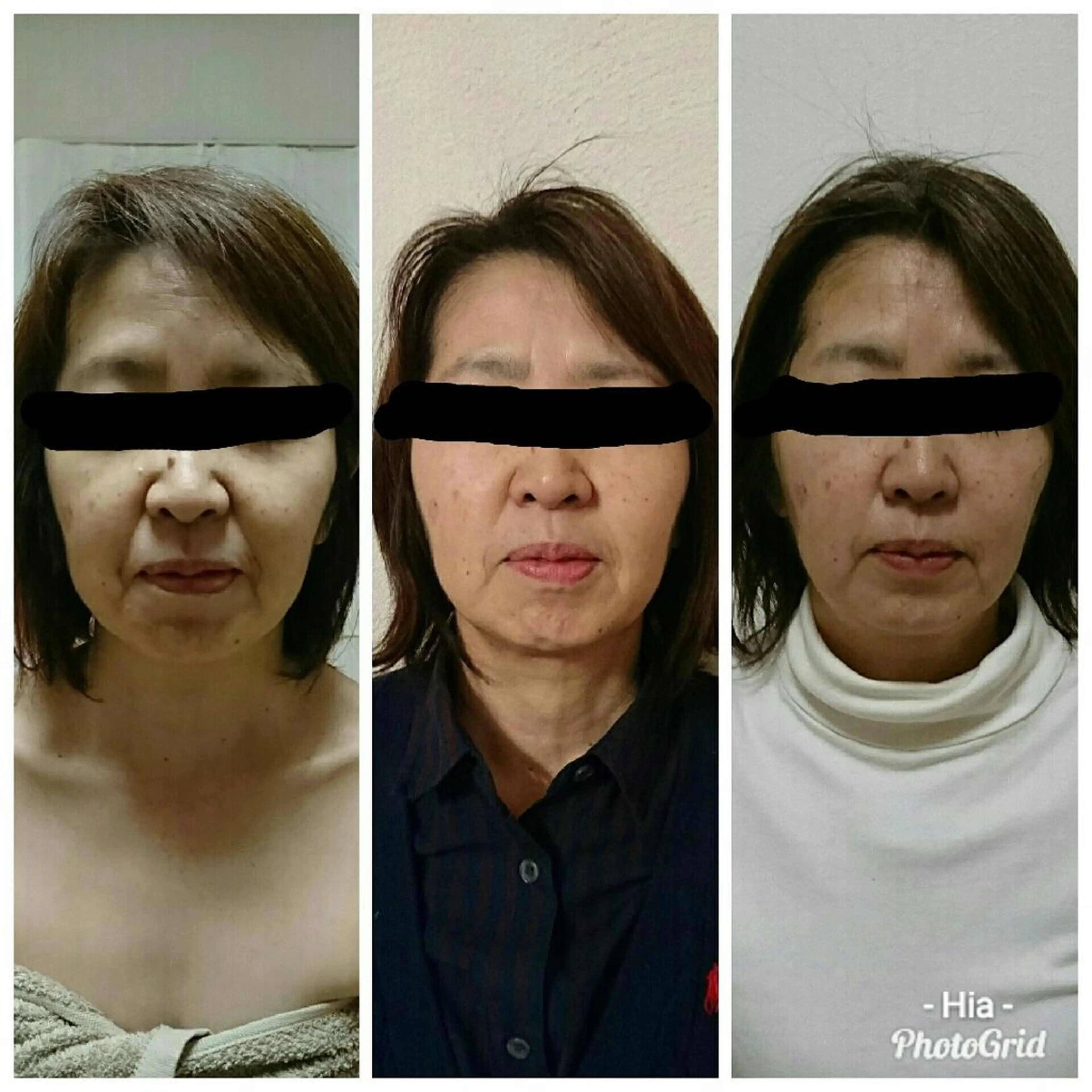エステ Salon de  HiAのエステ・リラクイメージ
