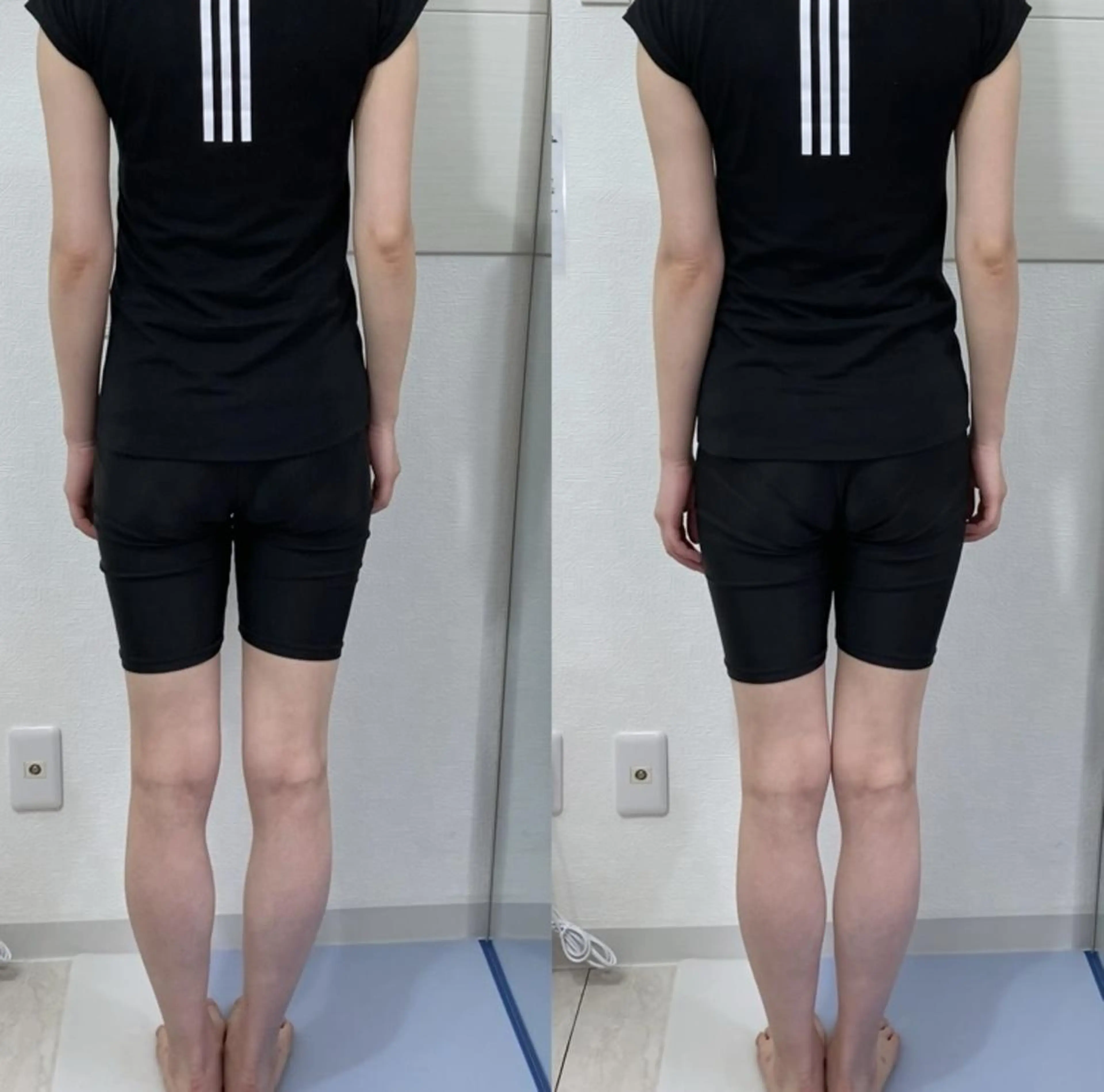 骨格美容整体 bimote.新宿のエステ・リラクイメージ