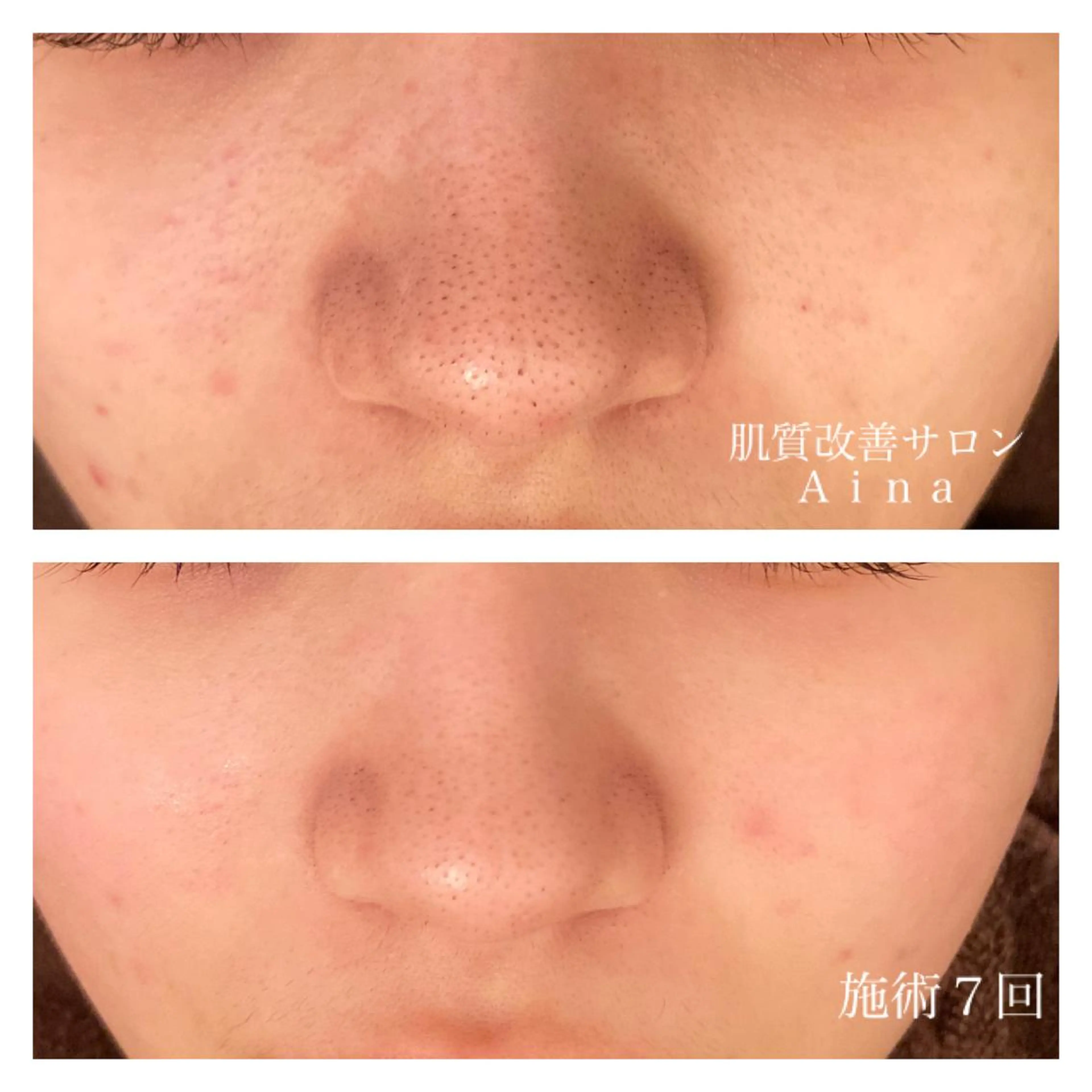 ミディアム カラー パーマ ヘアアレンジ メンズ キッズ ネイル マツエク・マツパ トリートメント ニキビ跡専門サロン Ａｉｎａのエステ・リラクイメージ