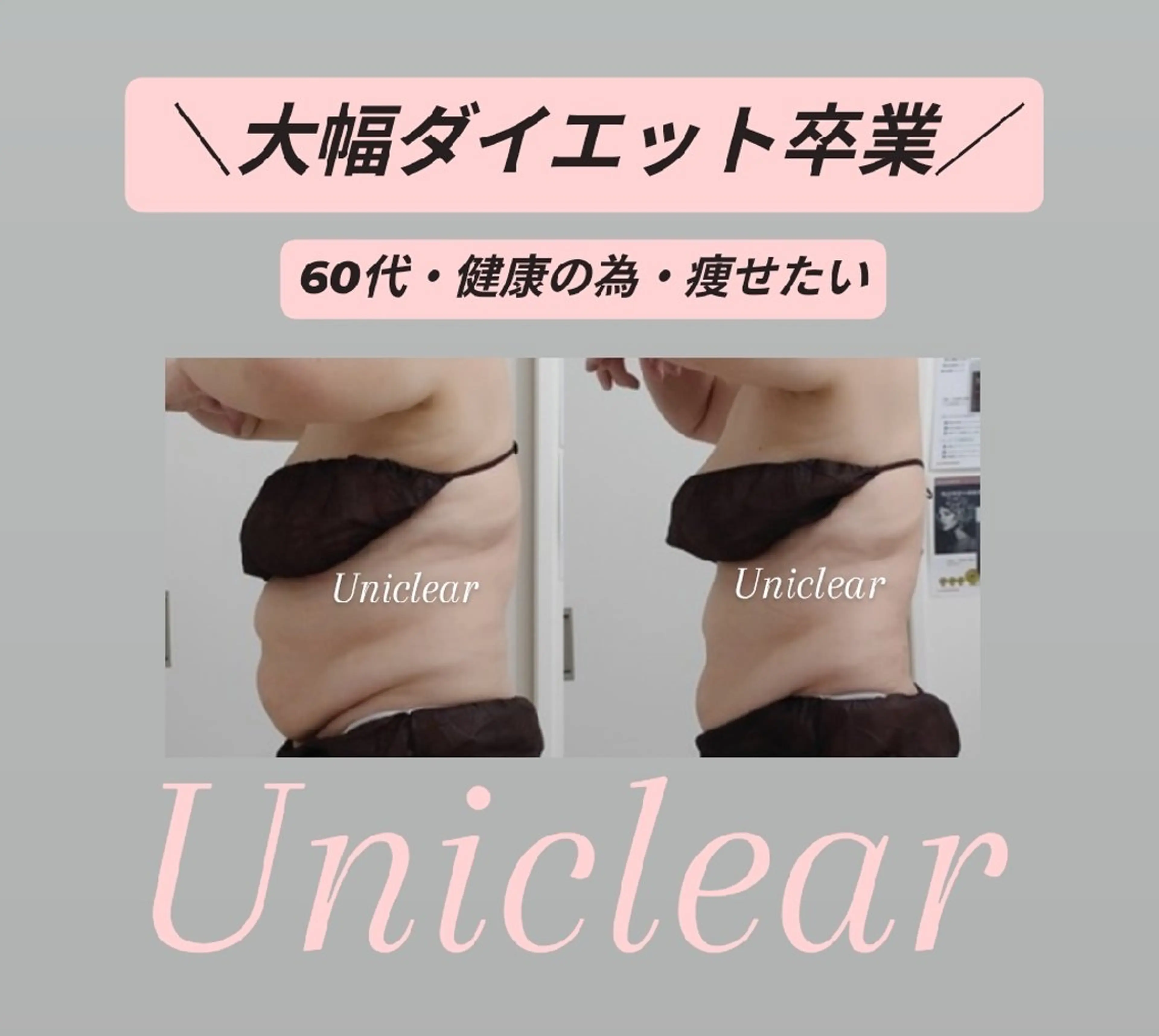 エステ リラク 佐賀痩身エステ/小顔 @uni.clearのエステ・リラクイメージ