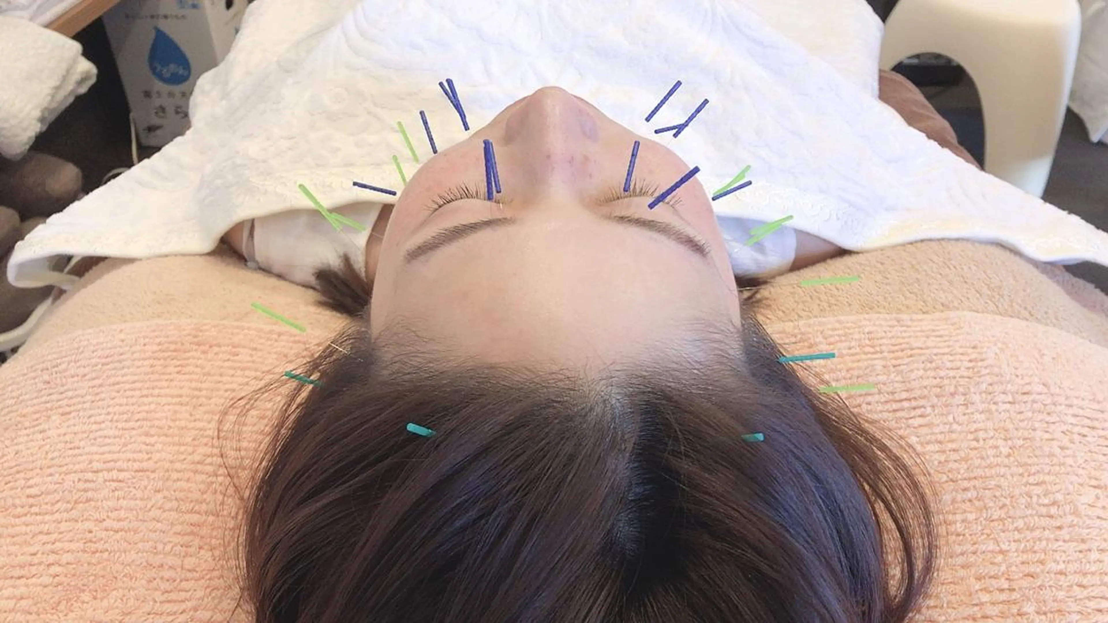 美容鍼・鍼灸専門❤✨ 近藤めぐみのエステ・リラクイメージ