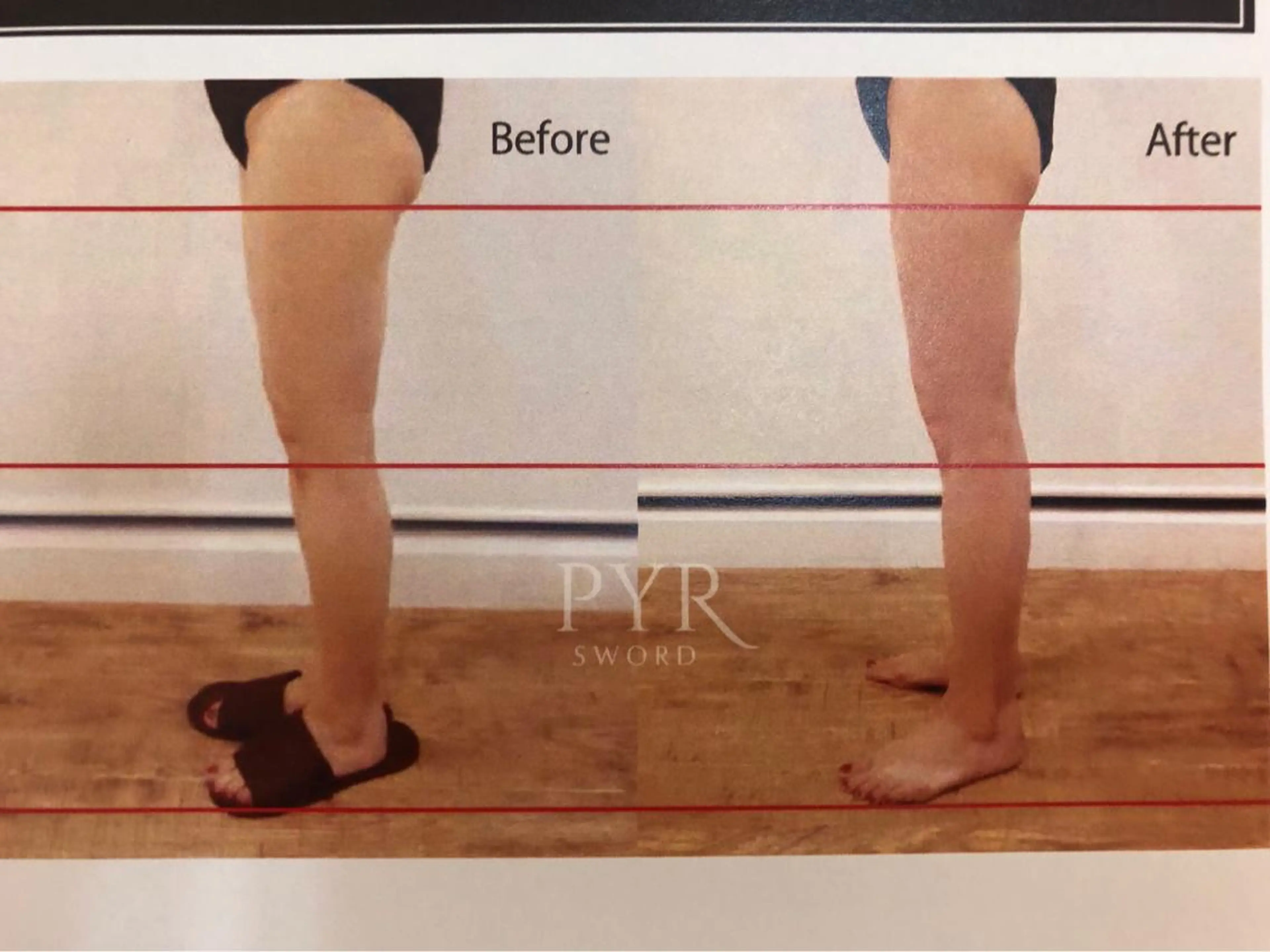 ネイル マツエク・マツパ 美容鍼専門 ハリエンジュのエステ・リラクイメージ