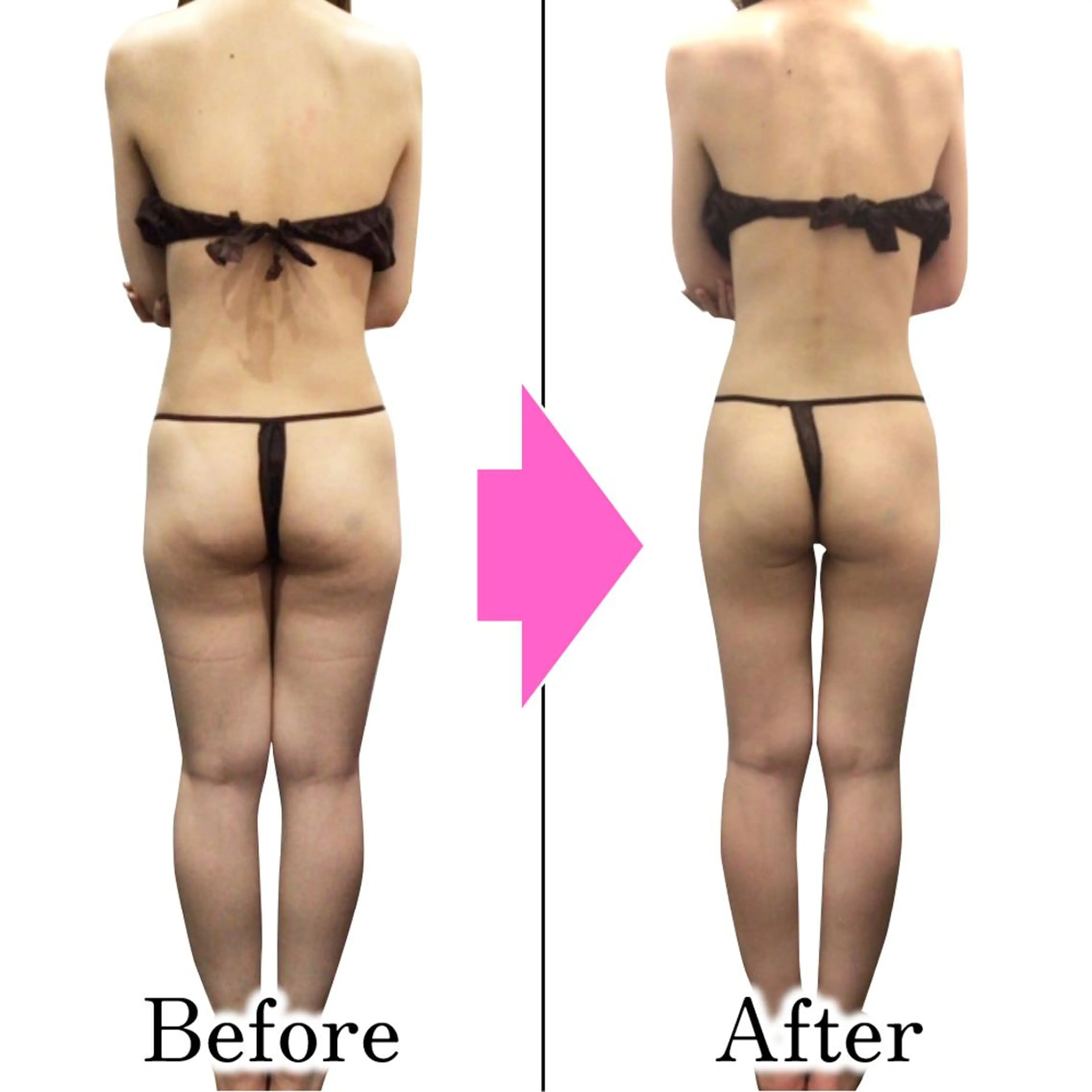 エステ ダイエットラボ梅田店 🌟のエステ・リラクイメージ