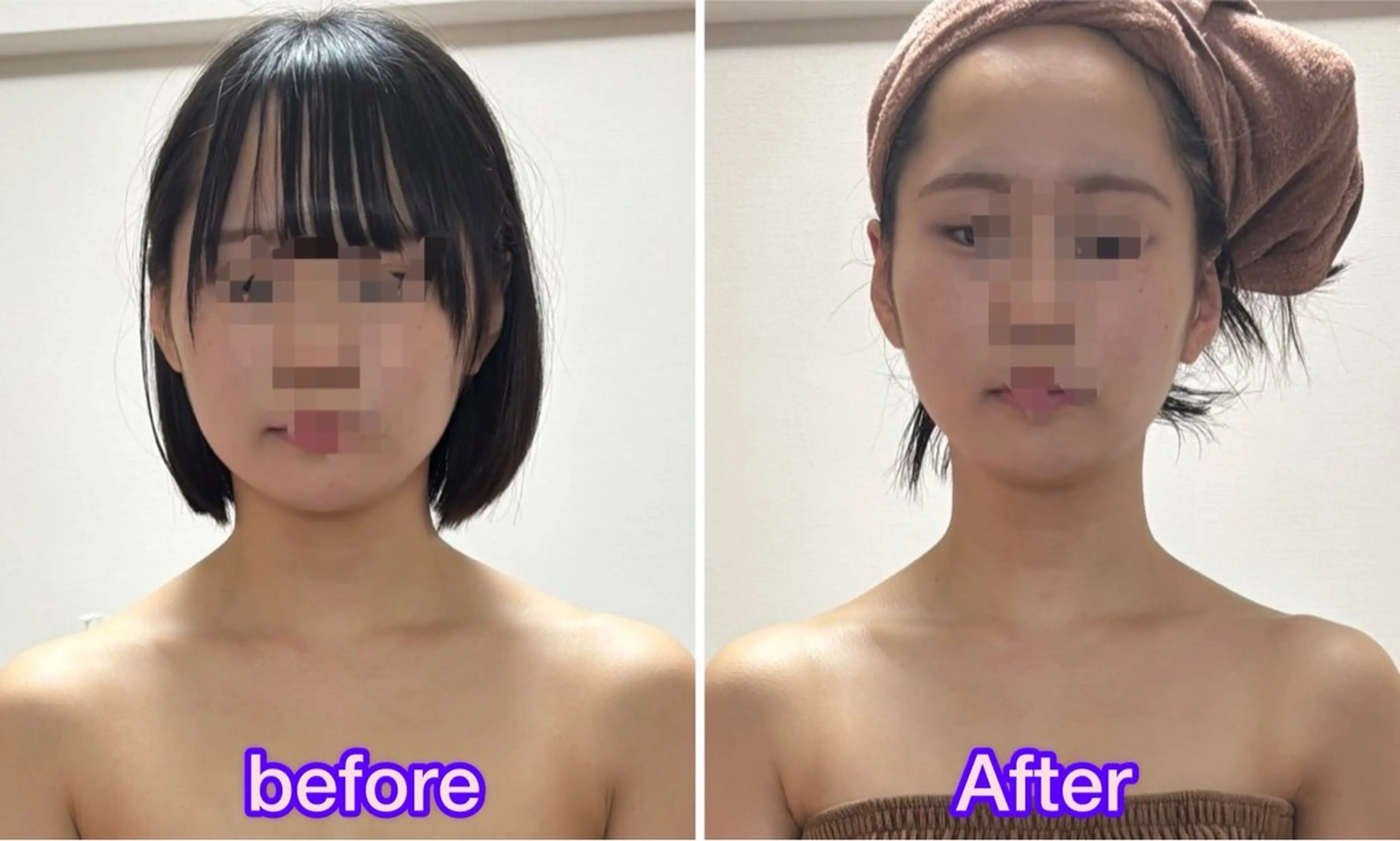 【人気のアイドル肩✨】フェイス＆デコルテ＆背中ケア♡メイクしたままOKで首肩スッキリ✨の写真