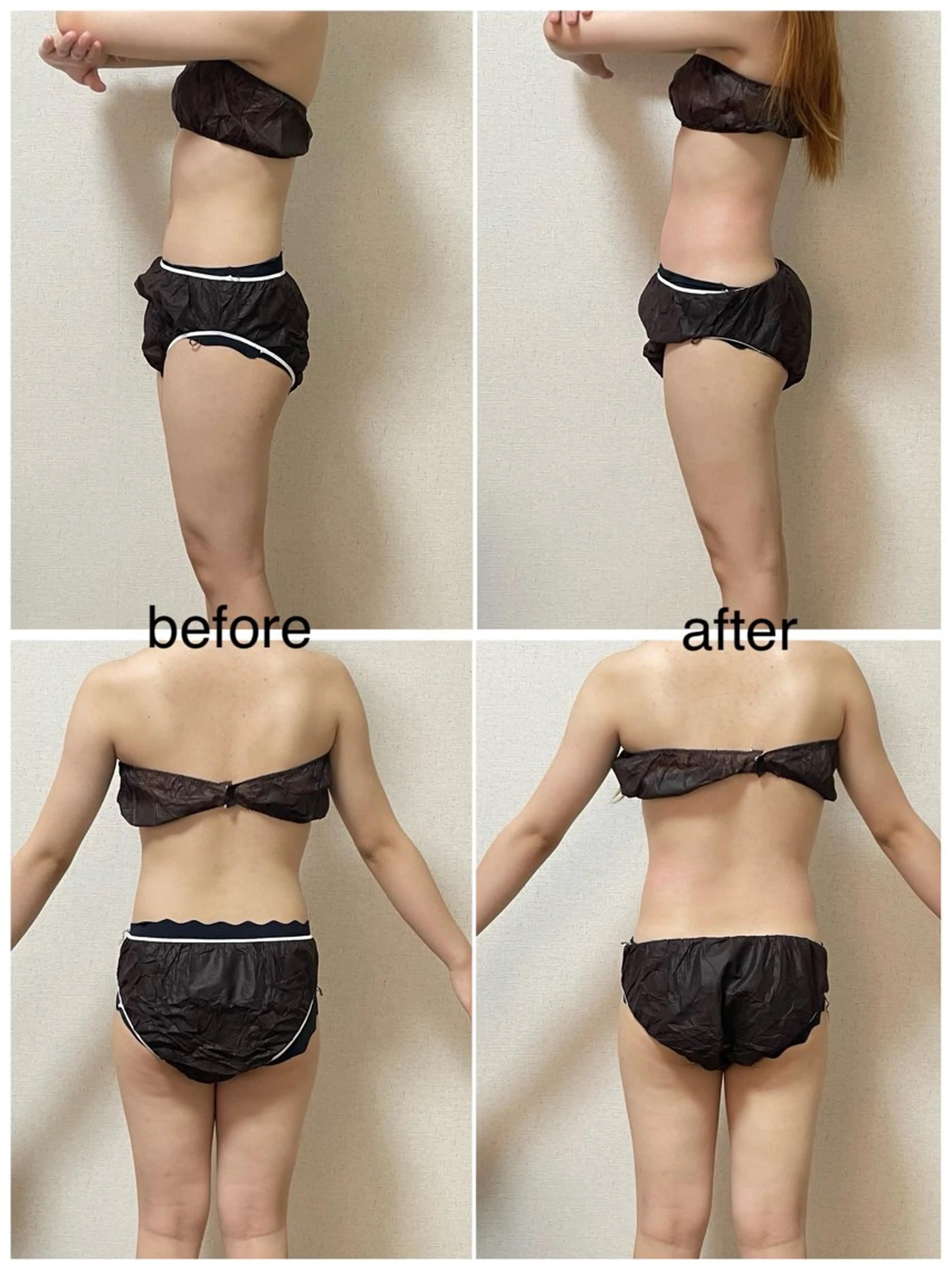 エステ カイロプラクティックグッドパートナー所属・🦴一柳きらら🦴 骨格調整の専門家のエステ・リラクイメージ