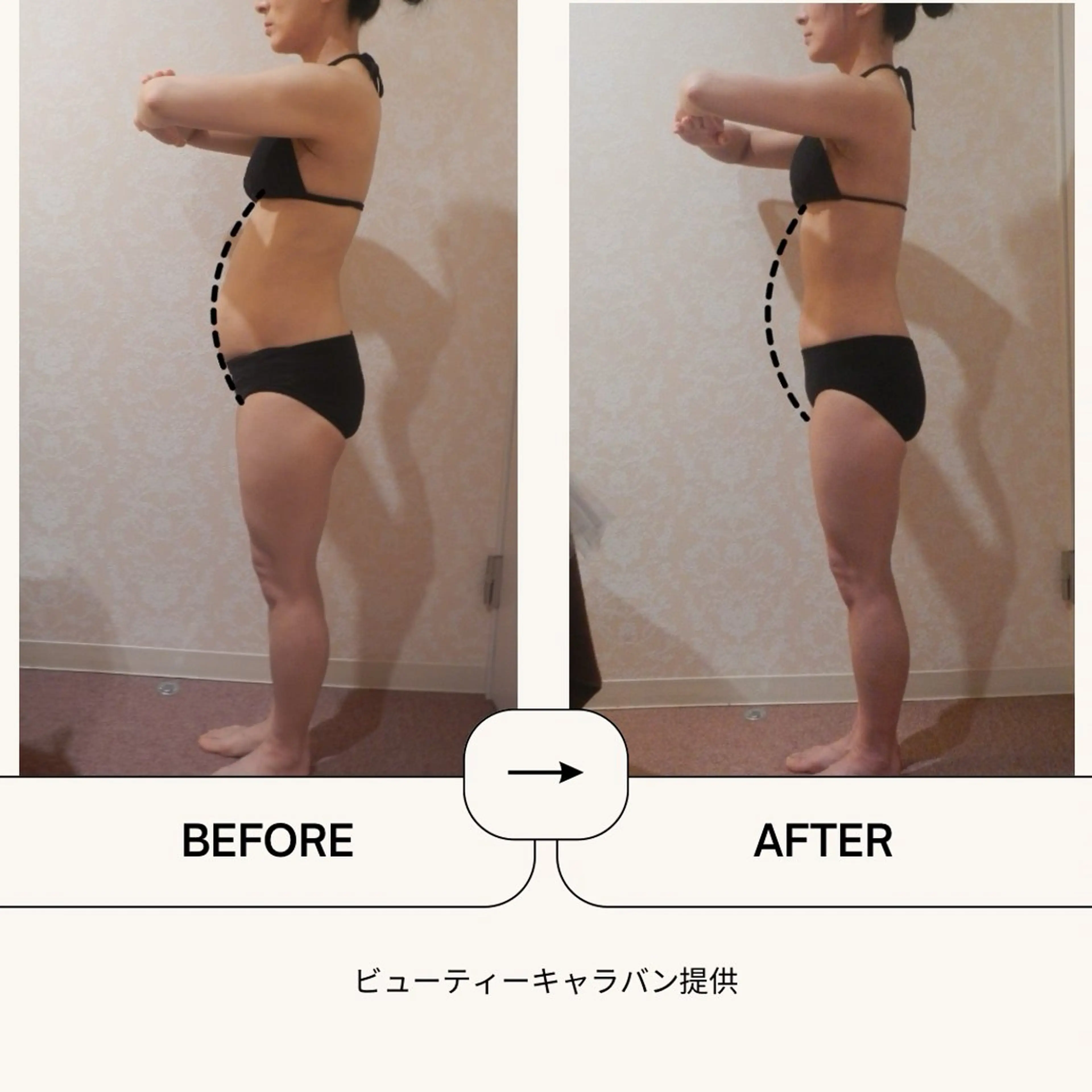 【初回限定36%OFF】 ラジオ波おためしコース✨【上半身/下半身/腰/腹部/脚/腕】の写真