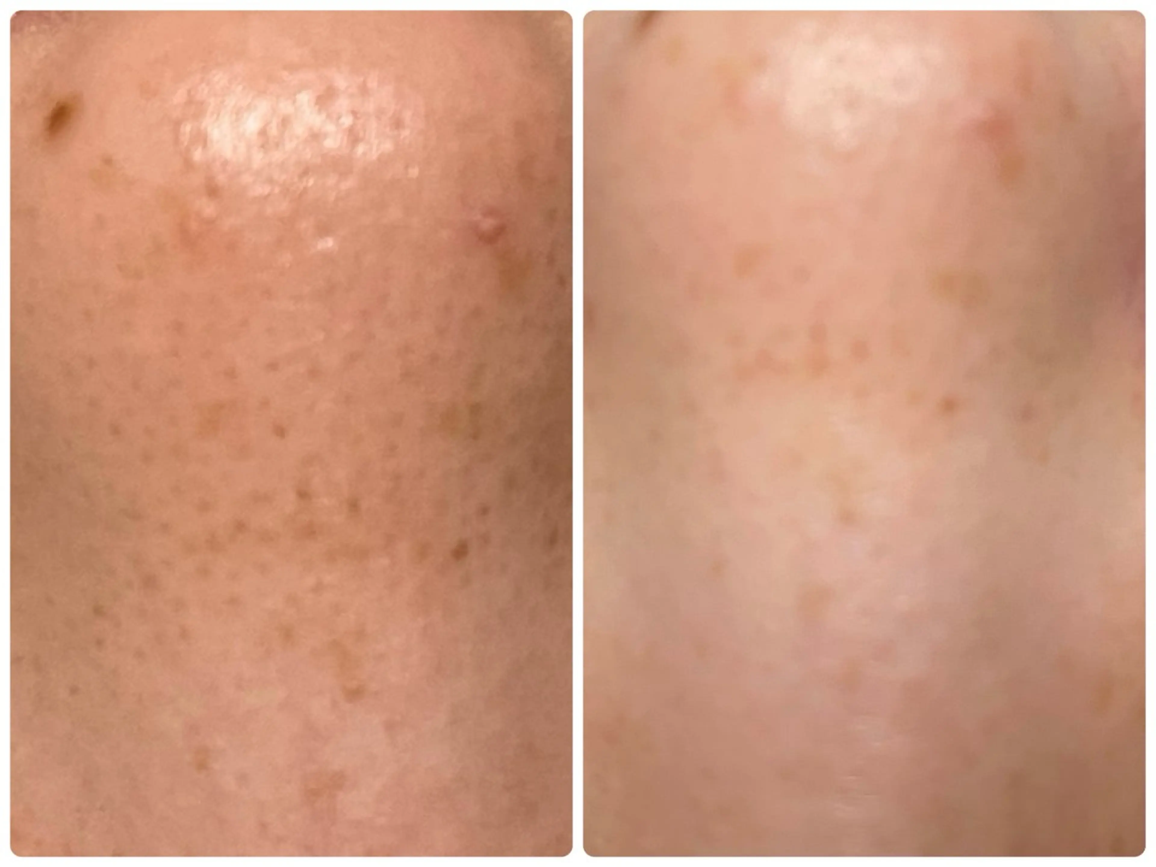 岸和田／久米田 MooMooのエステ・リラクイメージ