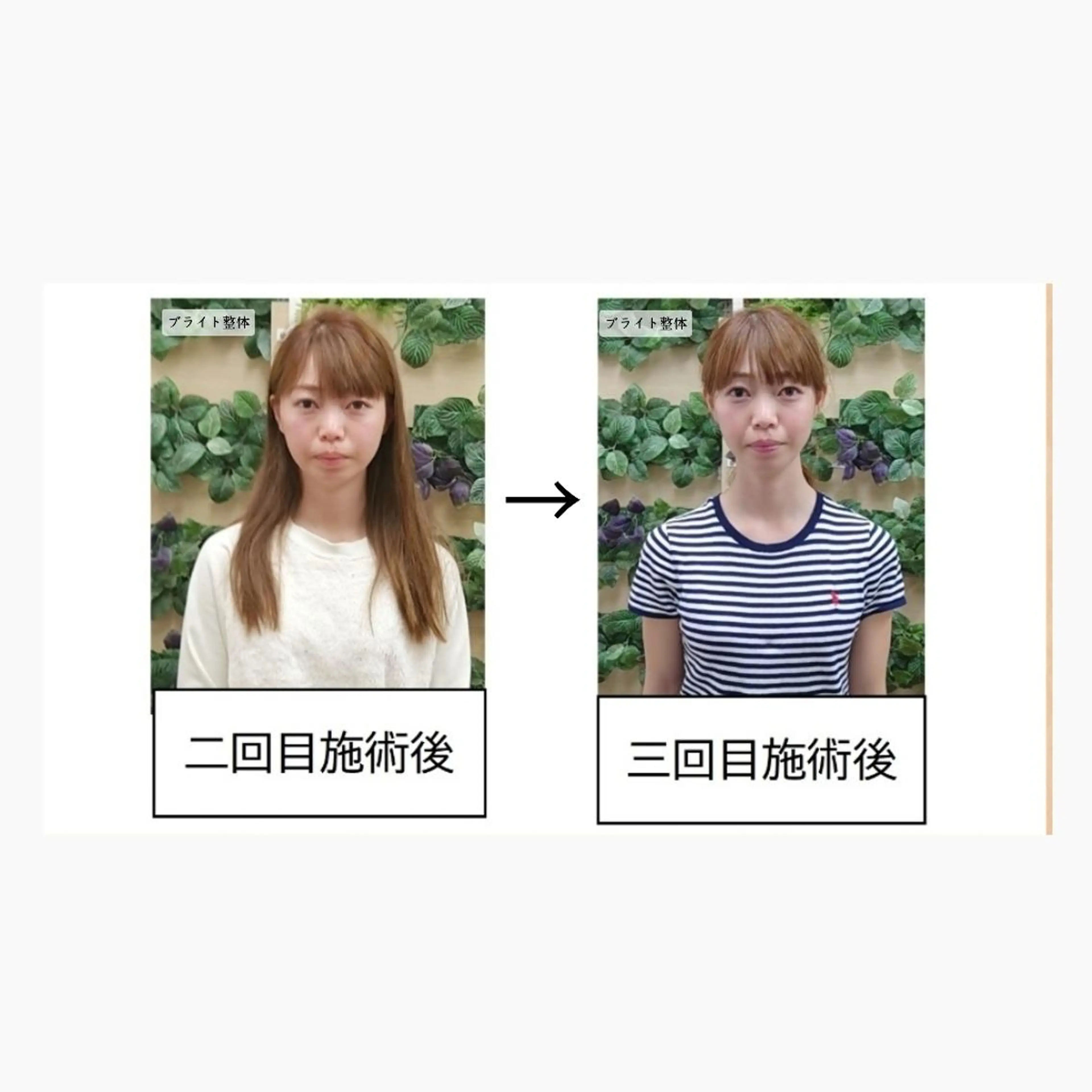 エステ リラク 小顔矯正 頭痛専門のブライト整体 所属・ブライト整体🟠 肩こり•腰痛•首こりのエステ・リラクイメージ