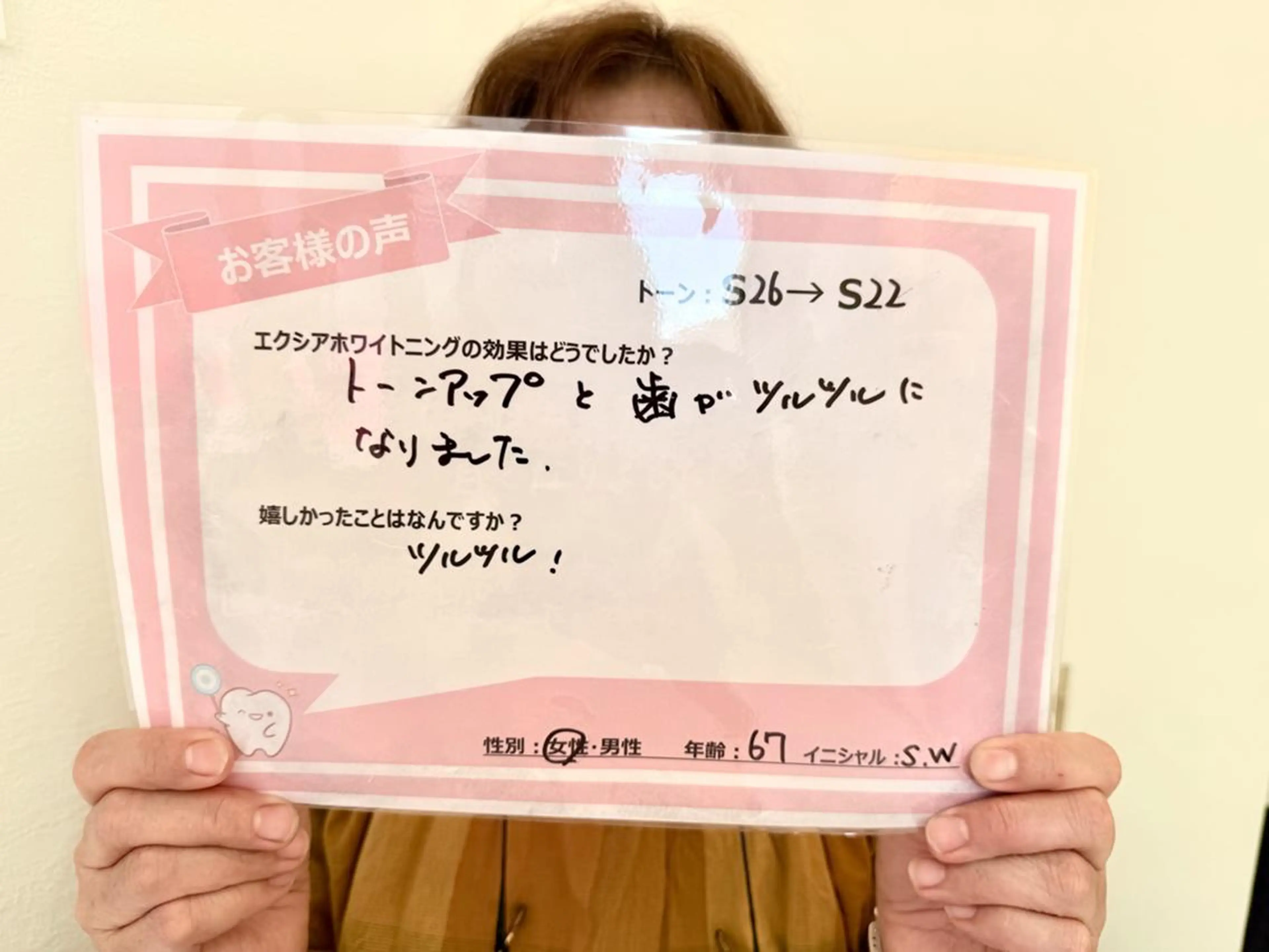 セルフホワイトニング エクシア金山のその他イメージ