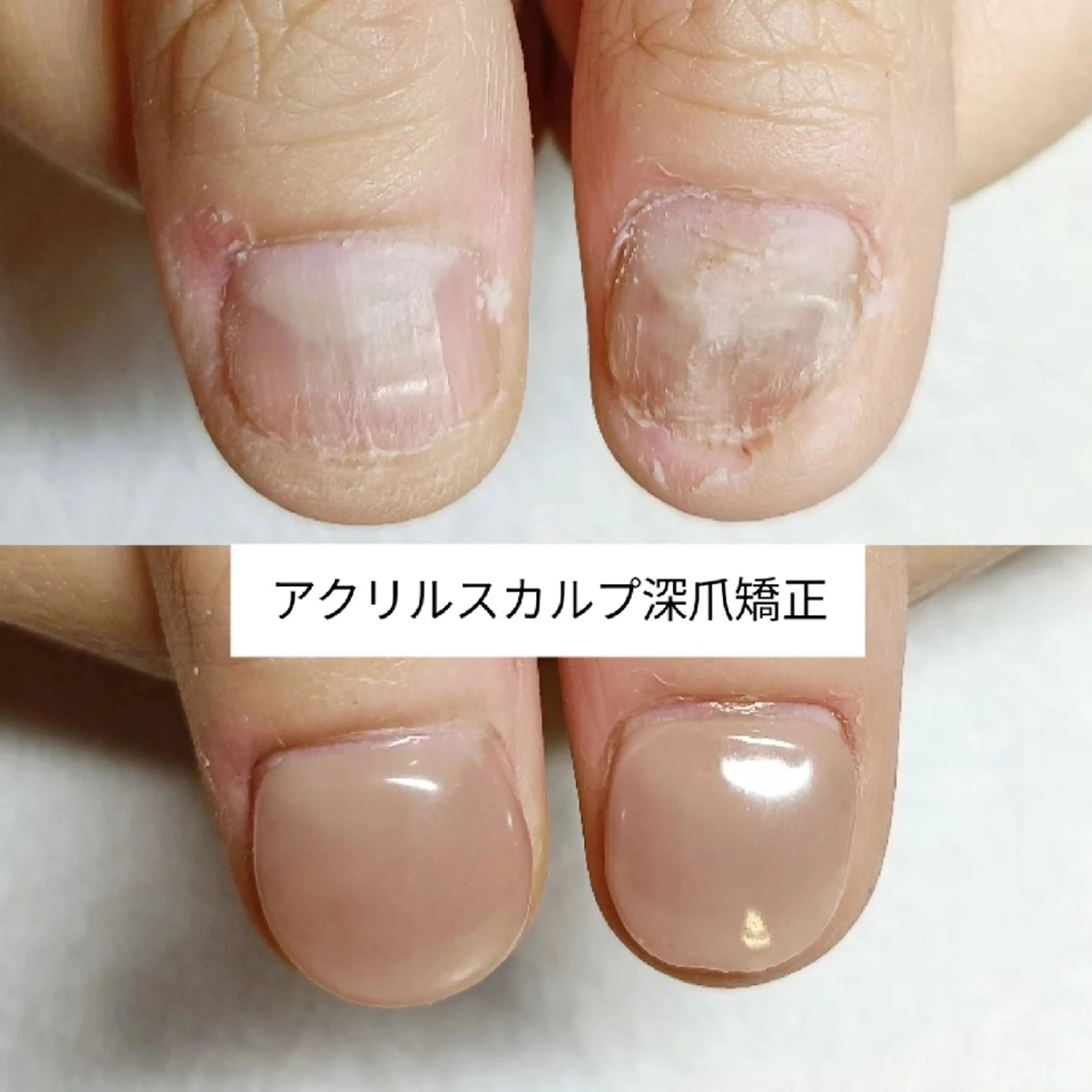 パーマ 深爪矯正/爪育成ケア manie nailのネイルデザイン