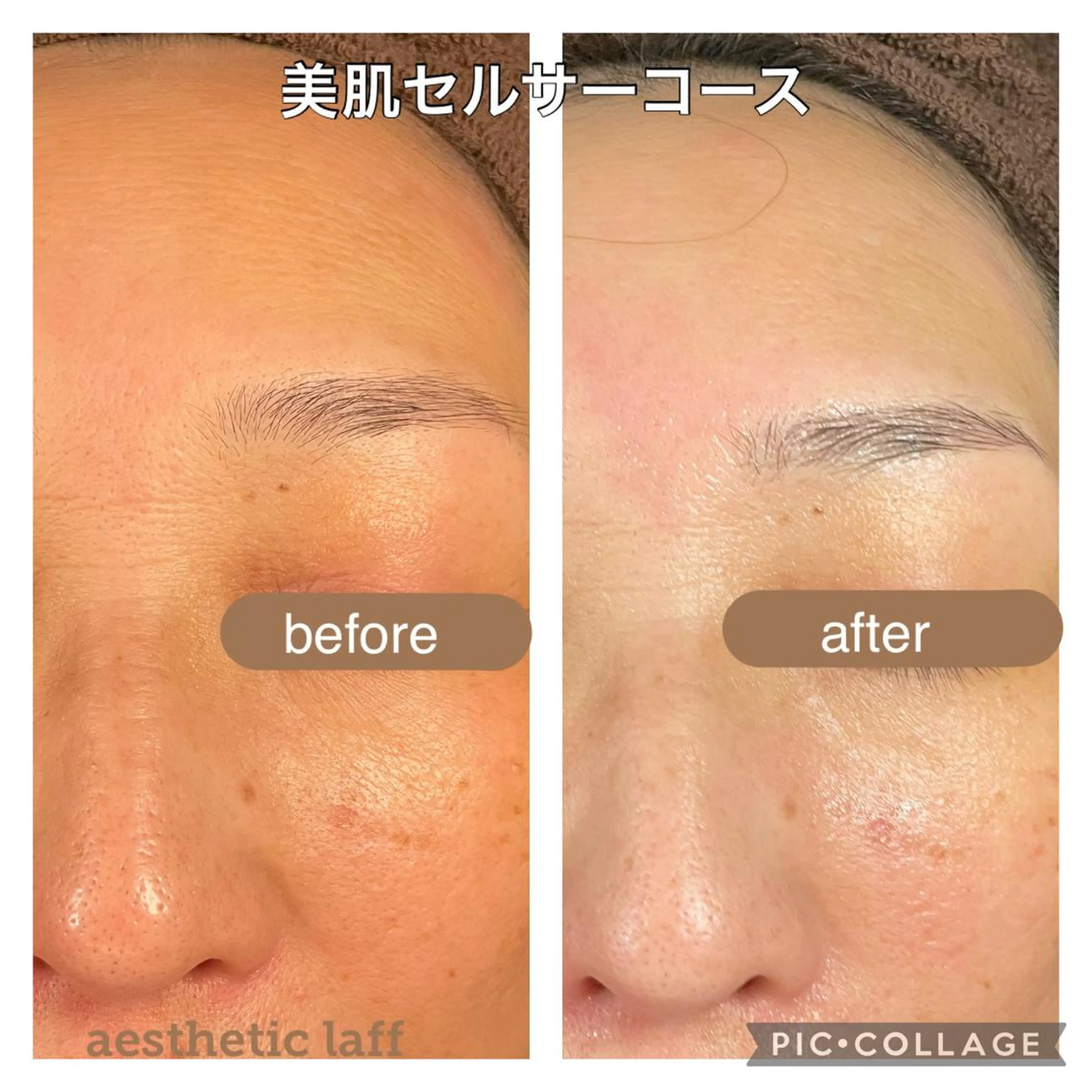 美肌作りのサロン 山村亜美のエステ・リラクイメージ