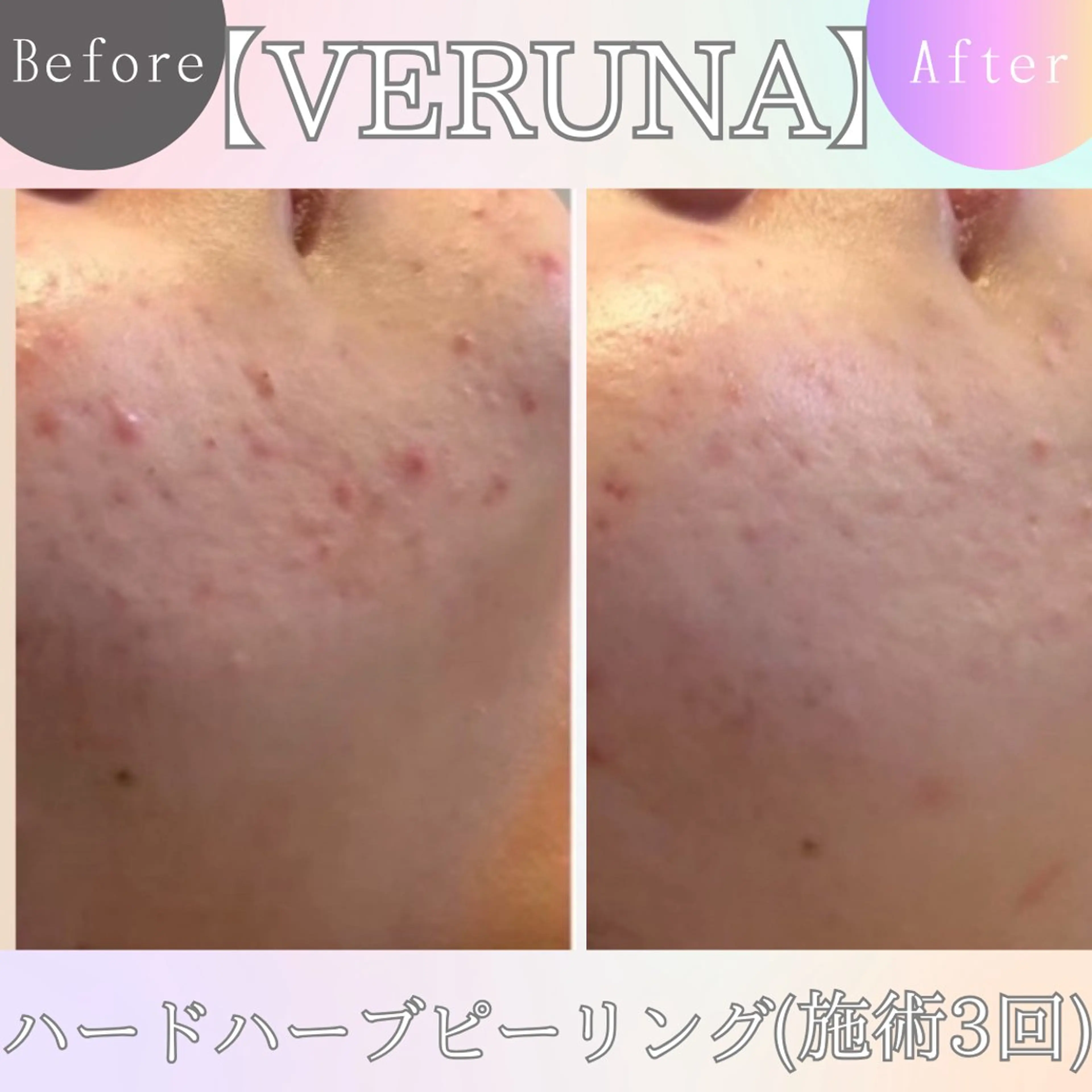 エステ 毛穴改善サロン d'Alba大阪住吉のエステ・リラクイメージ