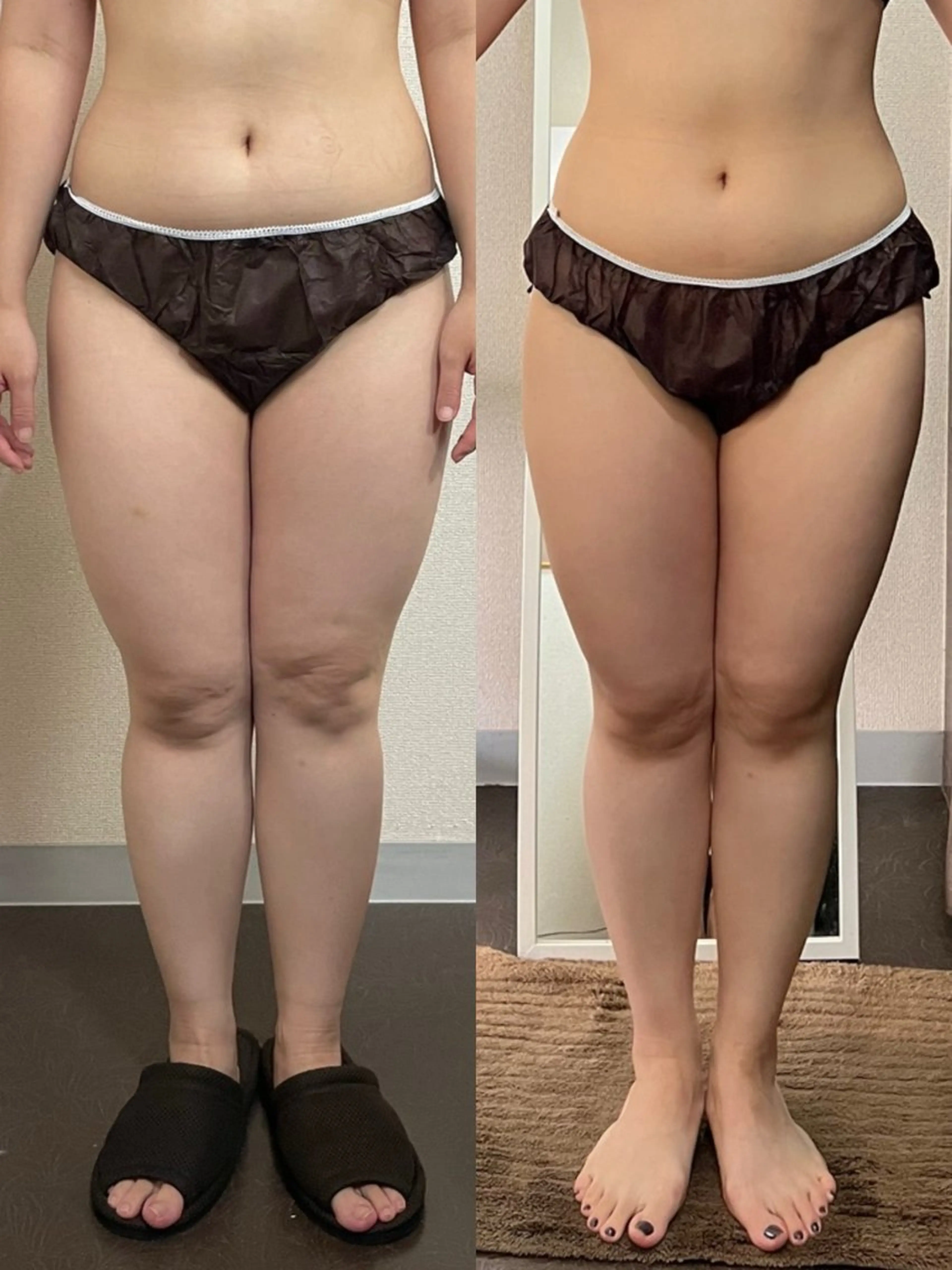 ハイパーナイフ専門店　Salon de COCO所属・Salon de COCOのエステ・リラクイメージ