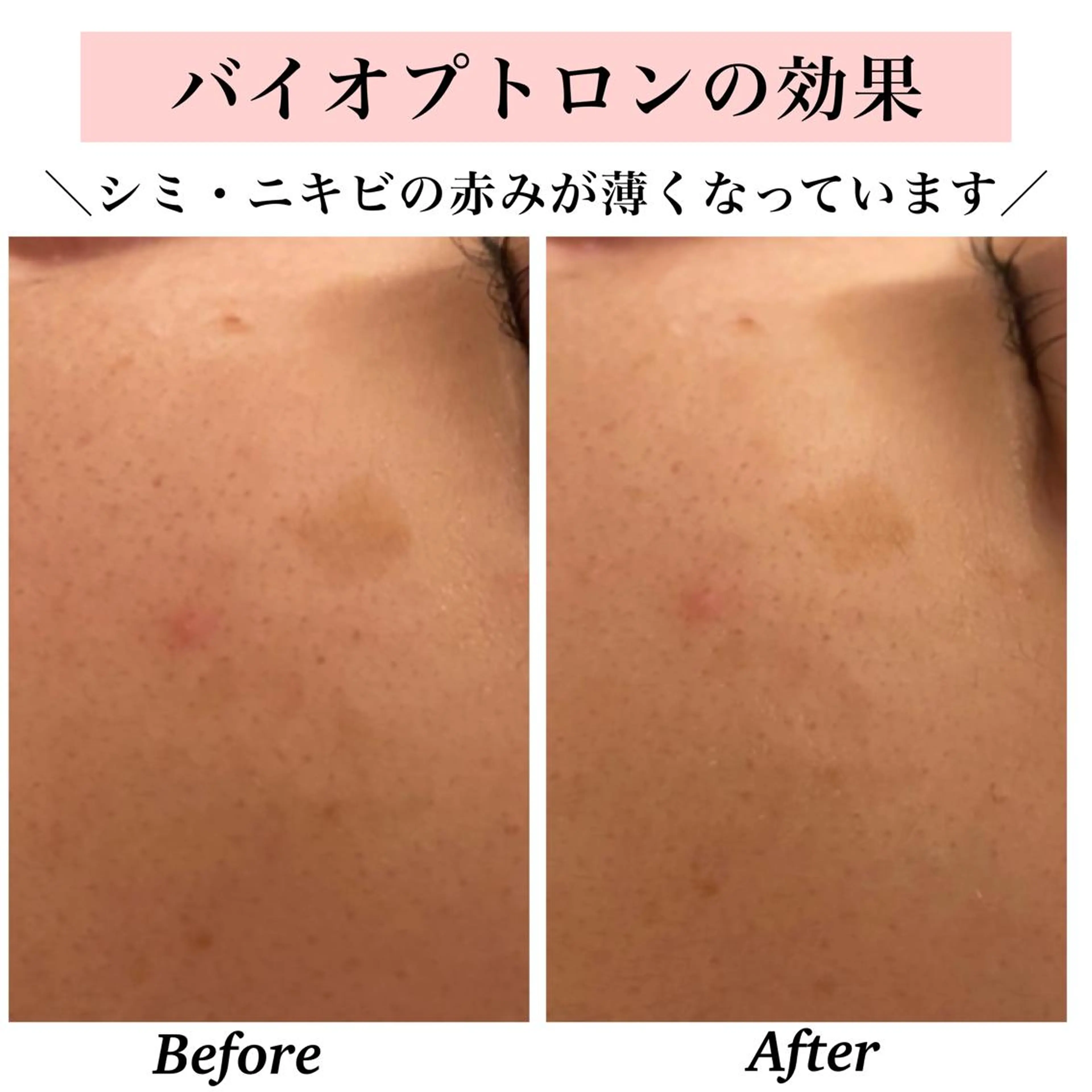 エステ リラク Bellesthe (ベルエステ)のエステ・リラクイメージ