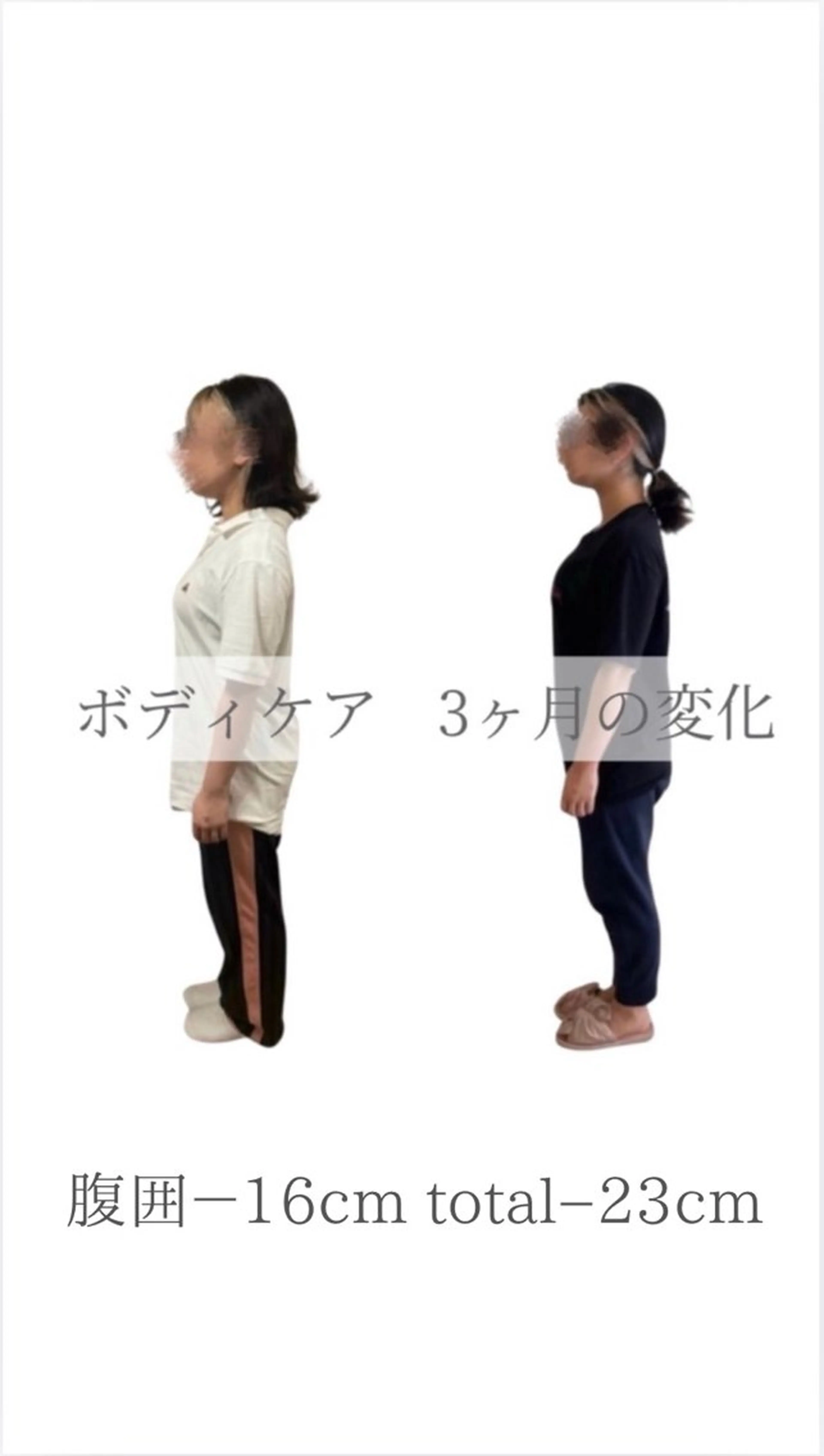 【カウンセリング込み】美ボディメイクの写真