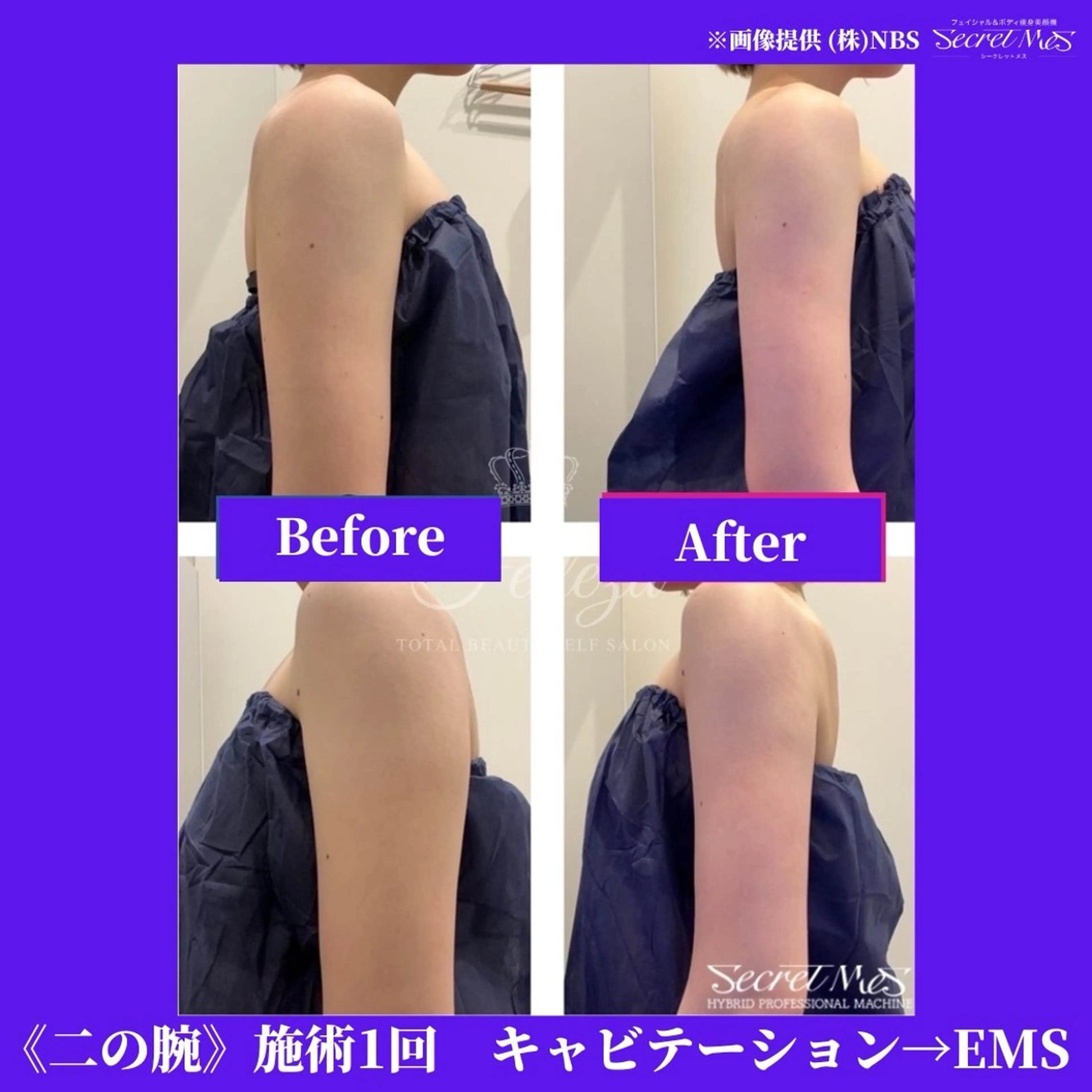 メンズ 有人型セルフサロン 脱毛／痩身／美顔のエステ・リラクイメージ