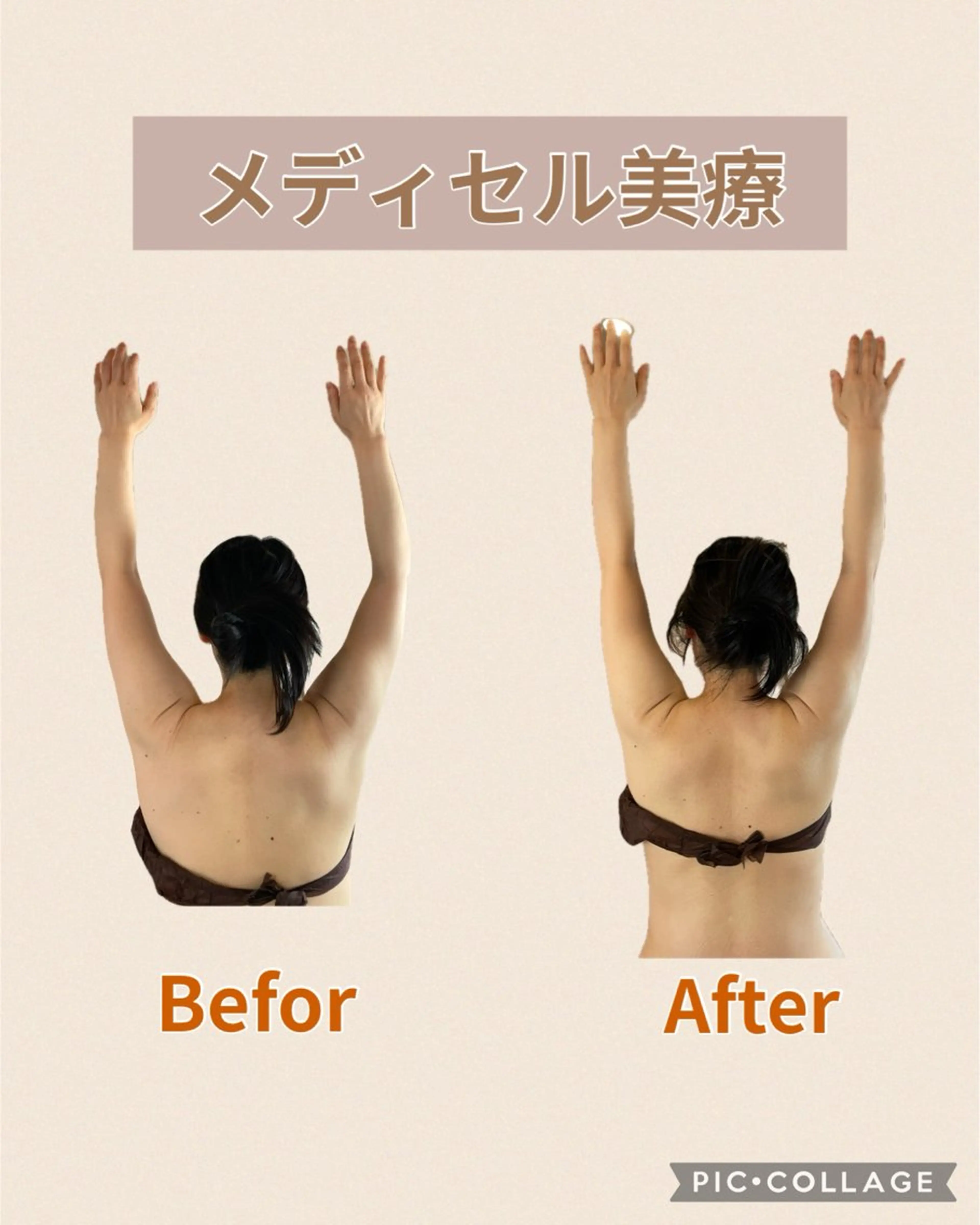 筋膜リリースサロン Embellirのエステ・リラクイメージ