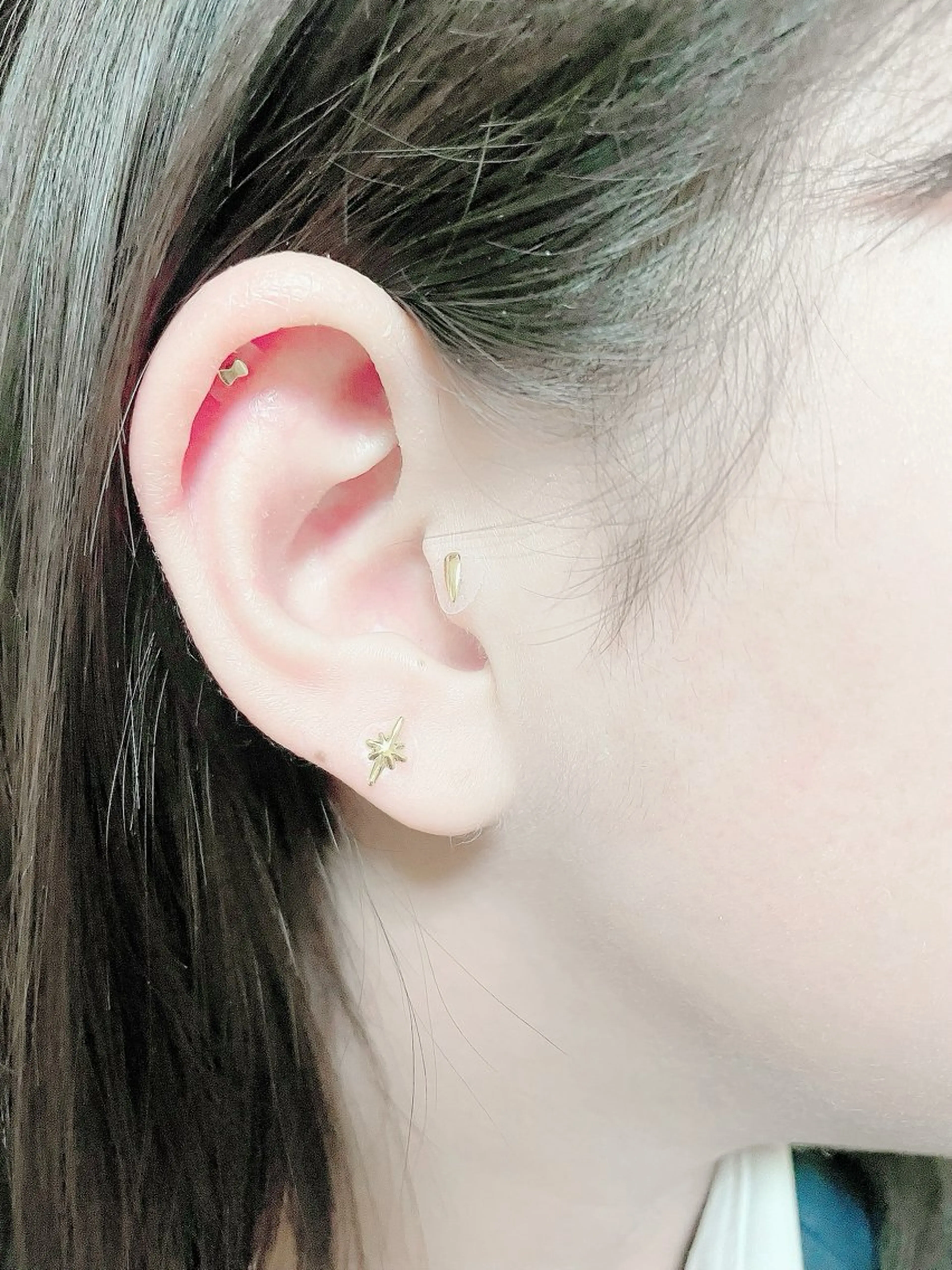 エステ リラク 痛くないシミ取り 【荻窪】石橋のヘアスタイル