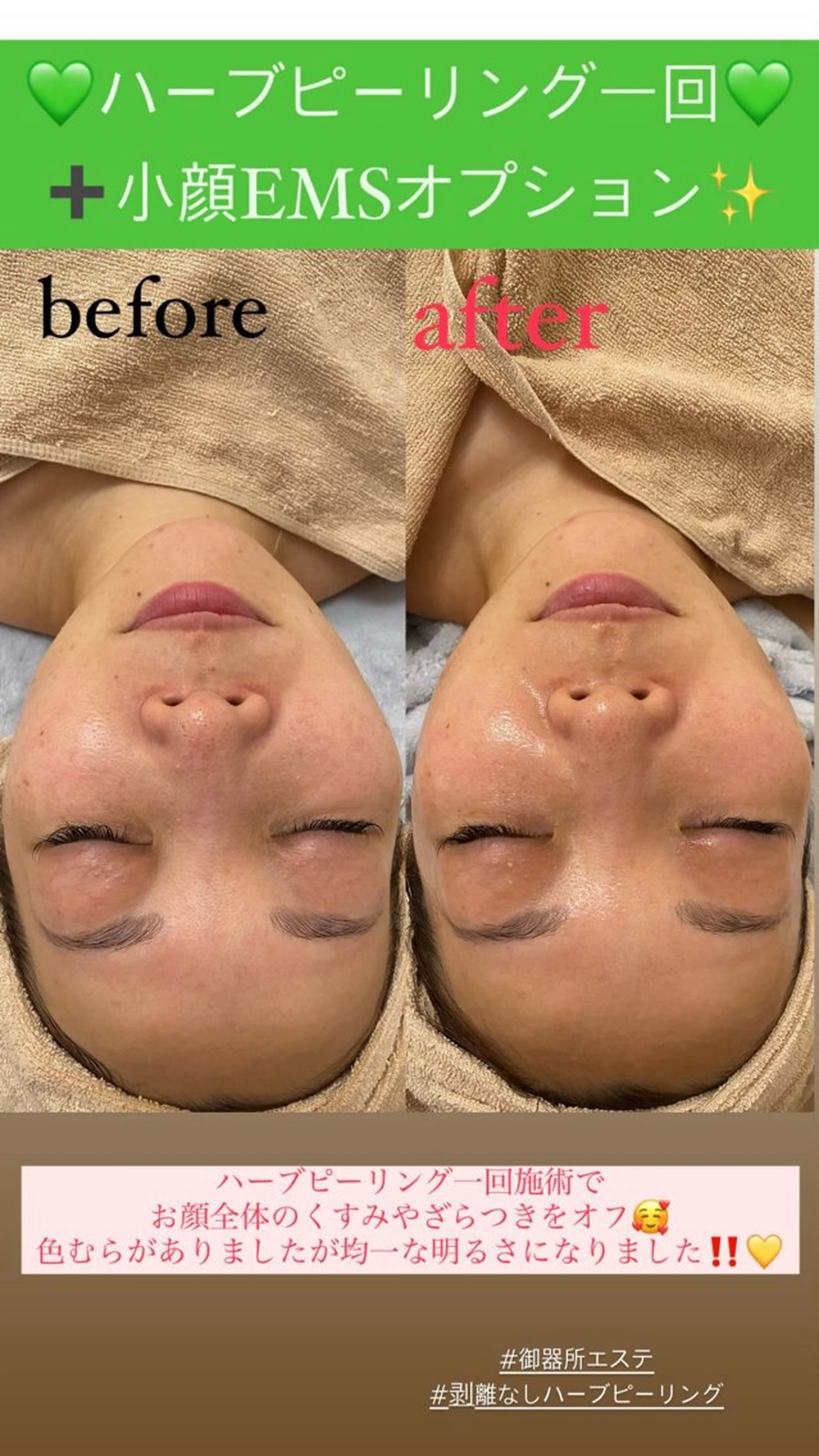 メンズ エステ Salon de Lino 御器所のエステ・リラクイメージ