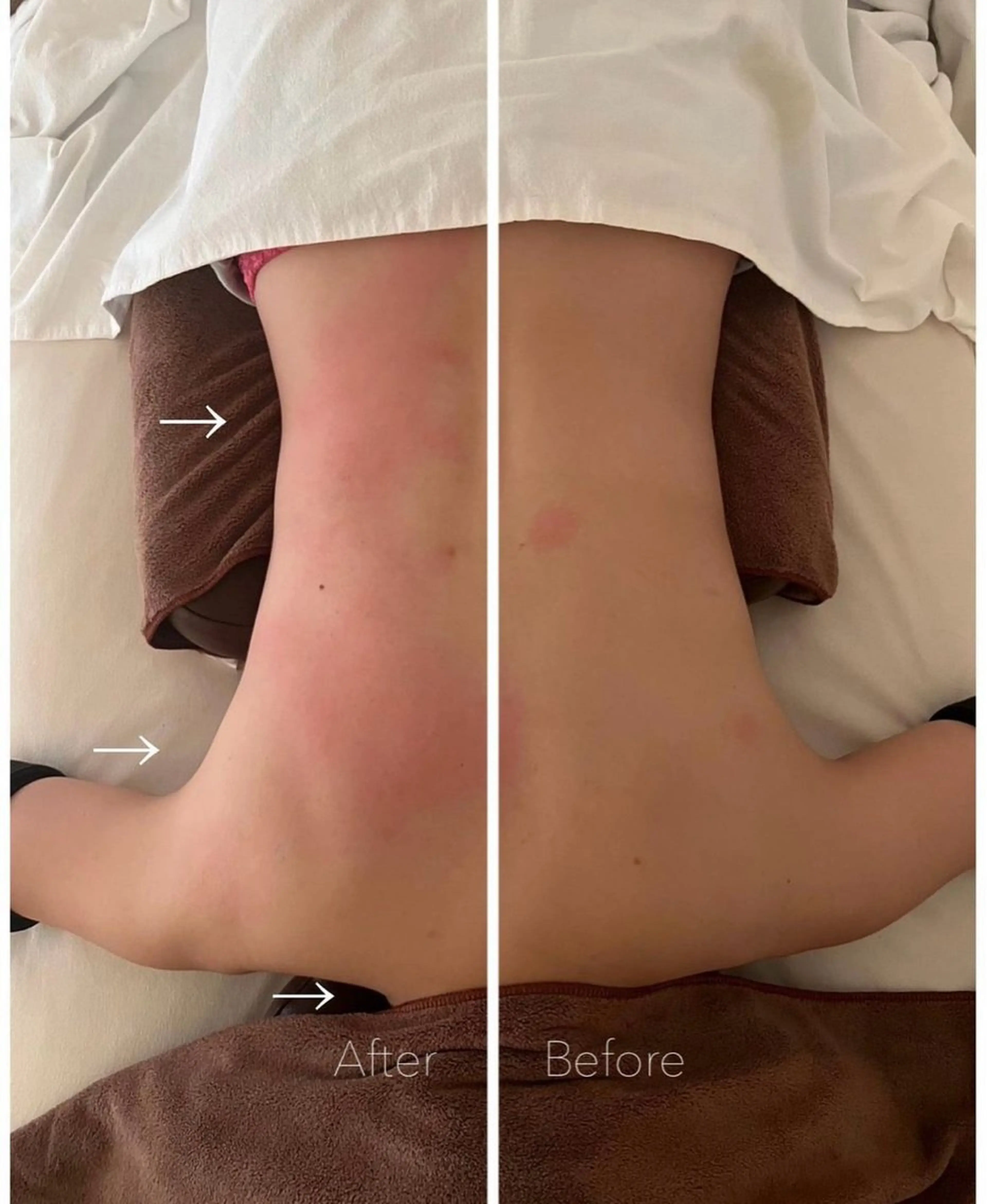 エステ リラク blossom沖縄所属・la　salon. chihoriのエステ・リラクイメージ