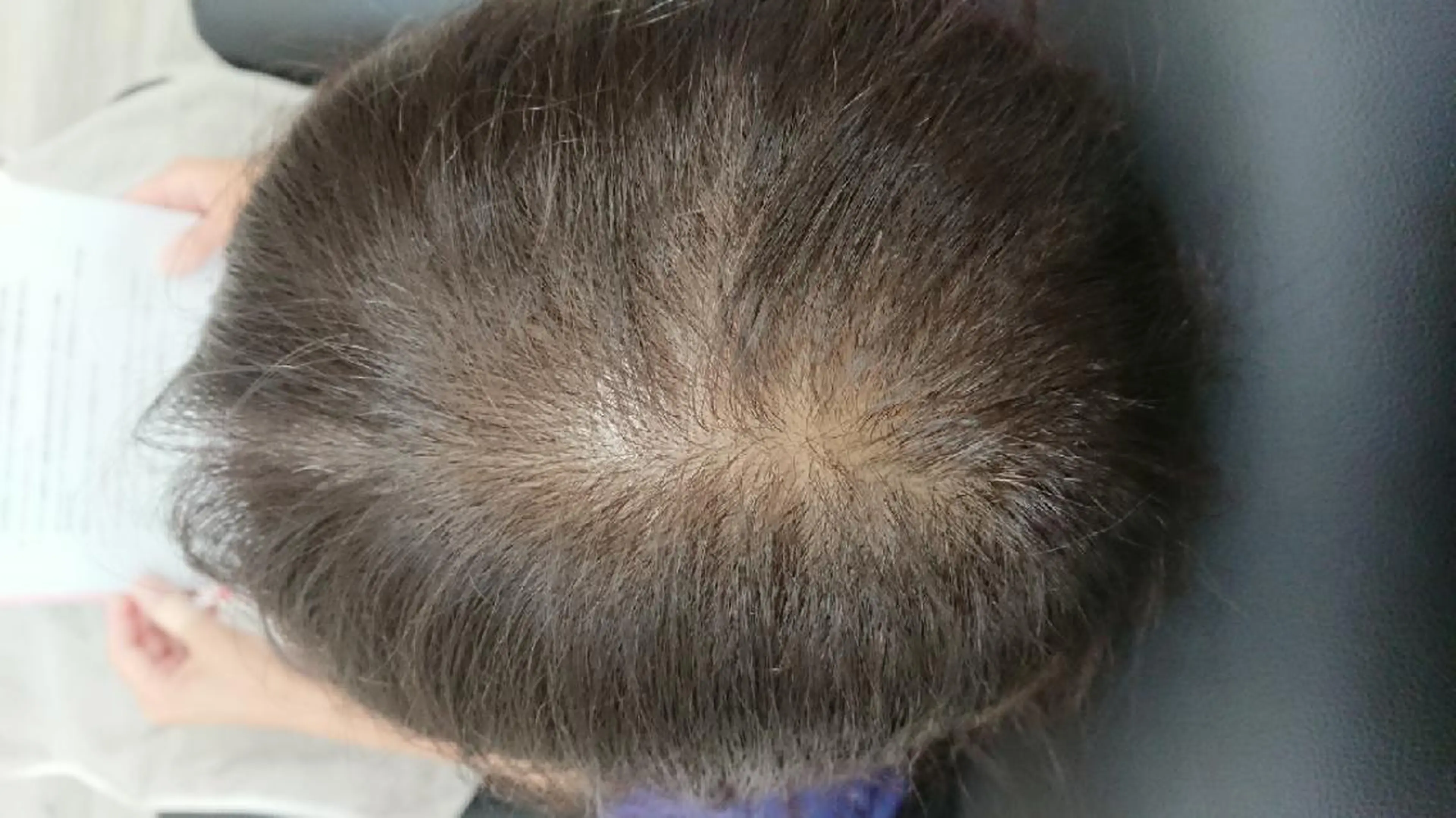 井之上 桂のヘアスタイル