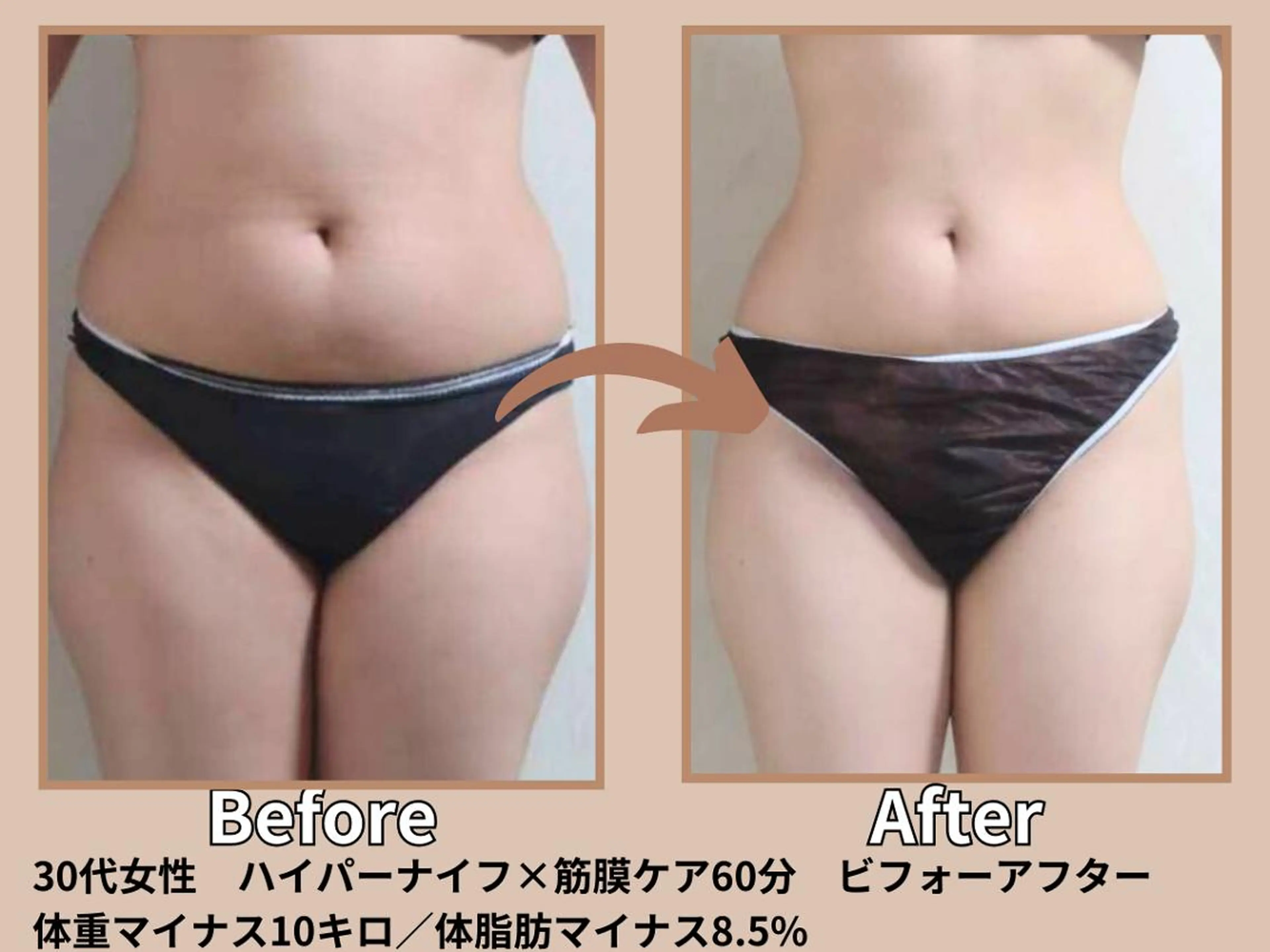 その他 痩身&小顔矯正専門店 Re:Livesのエステ・リラクイメージ