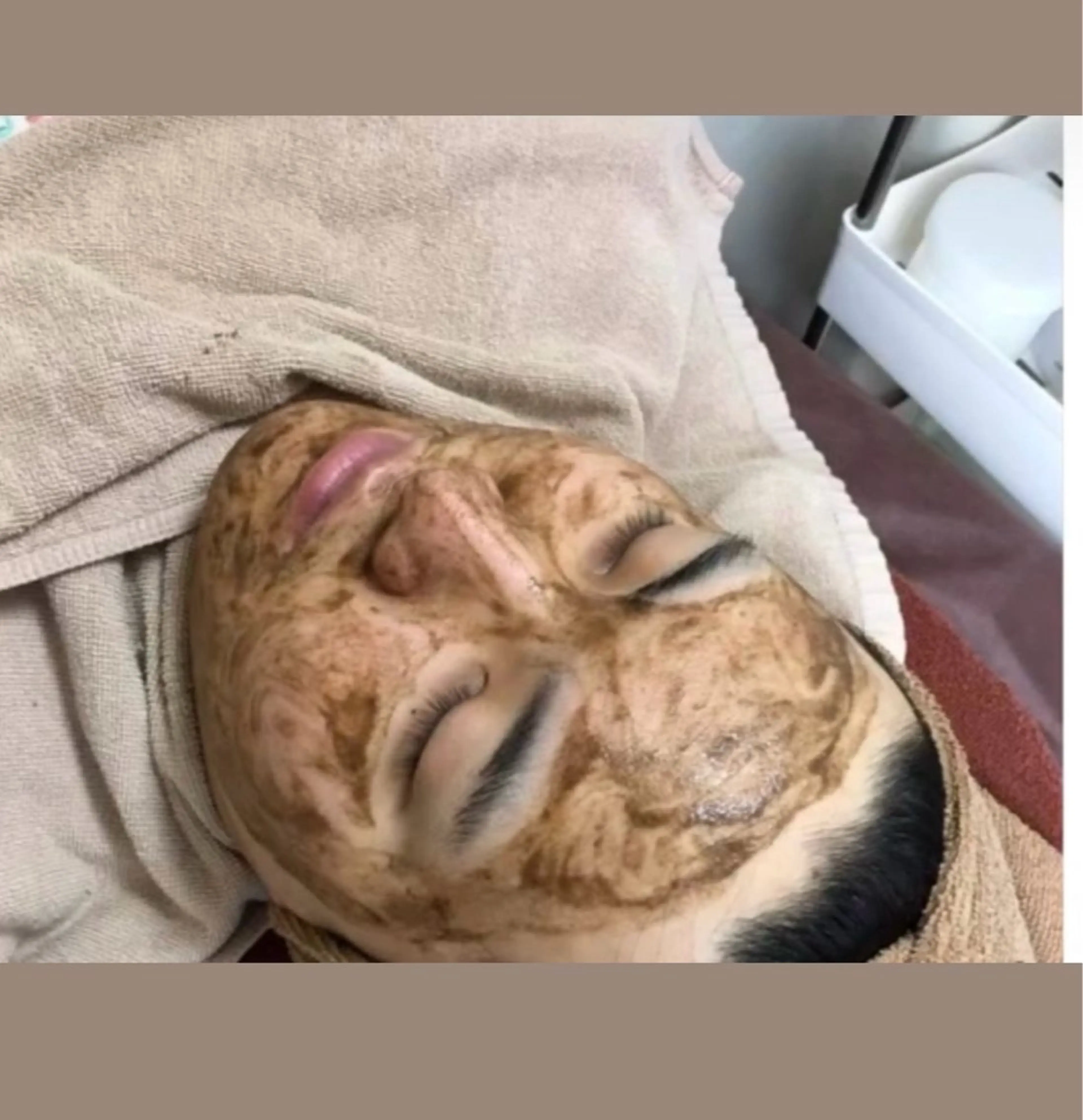 メンズ ハーブピーリング 専門店MOKA所属・ハーブピーリング専門 MOKAのエステ・リラクイメージ