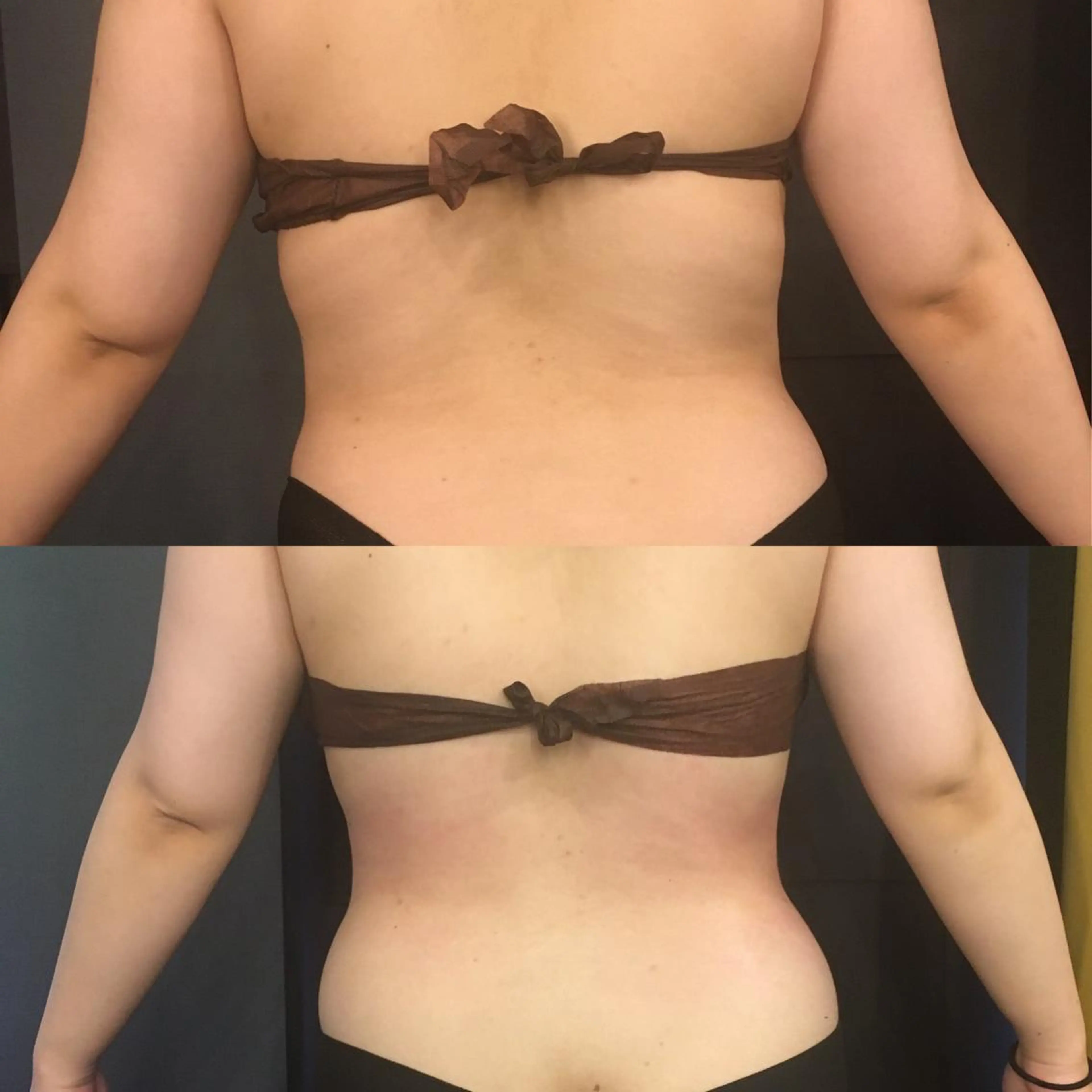 【痩身】当店人気No.1痩身🏅サーモシェイプDeepでスッキリ美Body🔥の写真