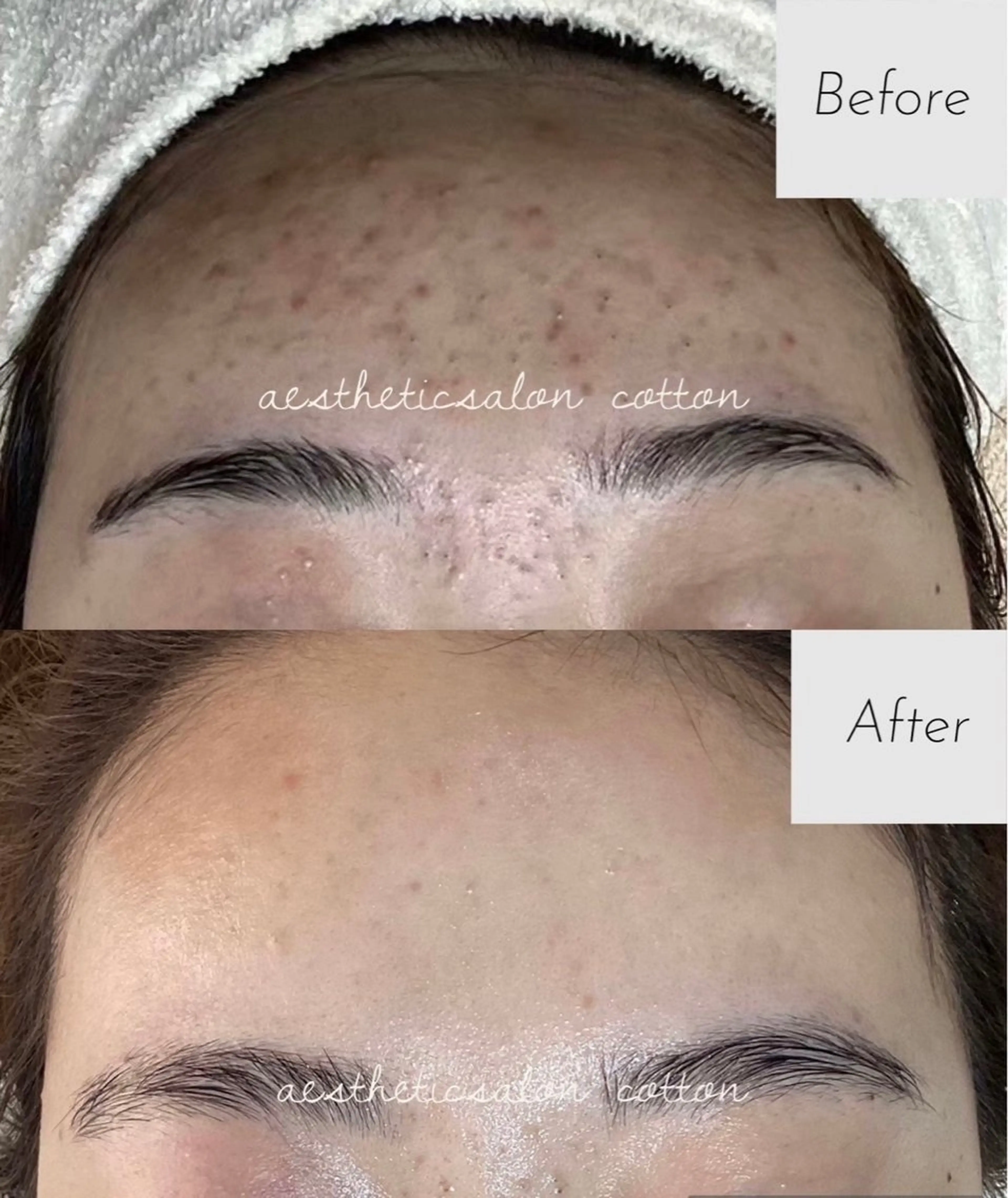 エステ 都度払い 肌質改善専門サロンのエステ・リラクイメージ