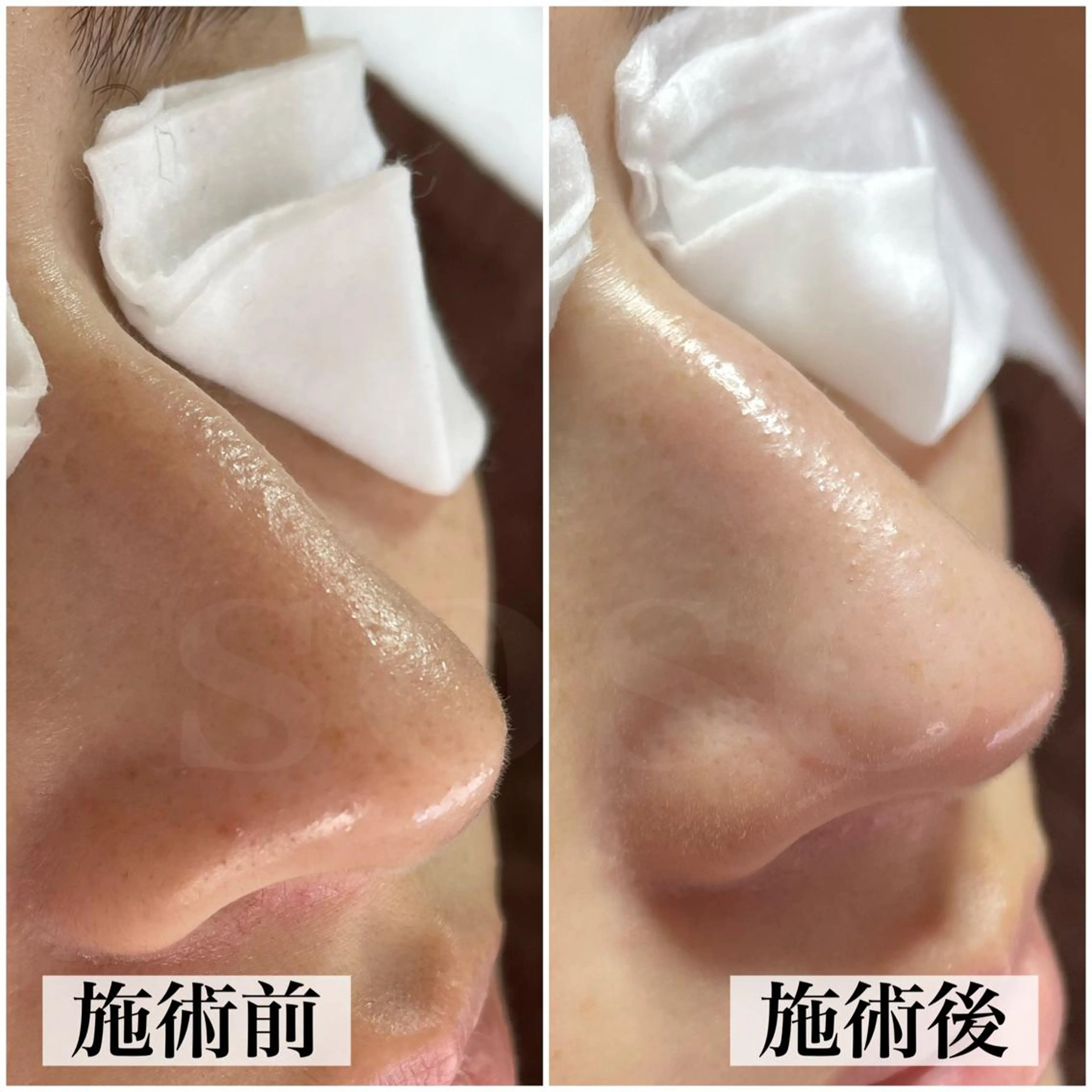 エステ salon soso(ソソ)のエステ・リラクイメージ