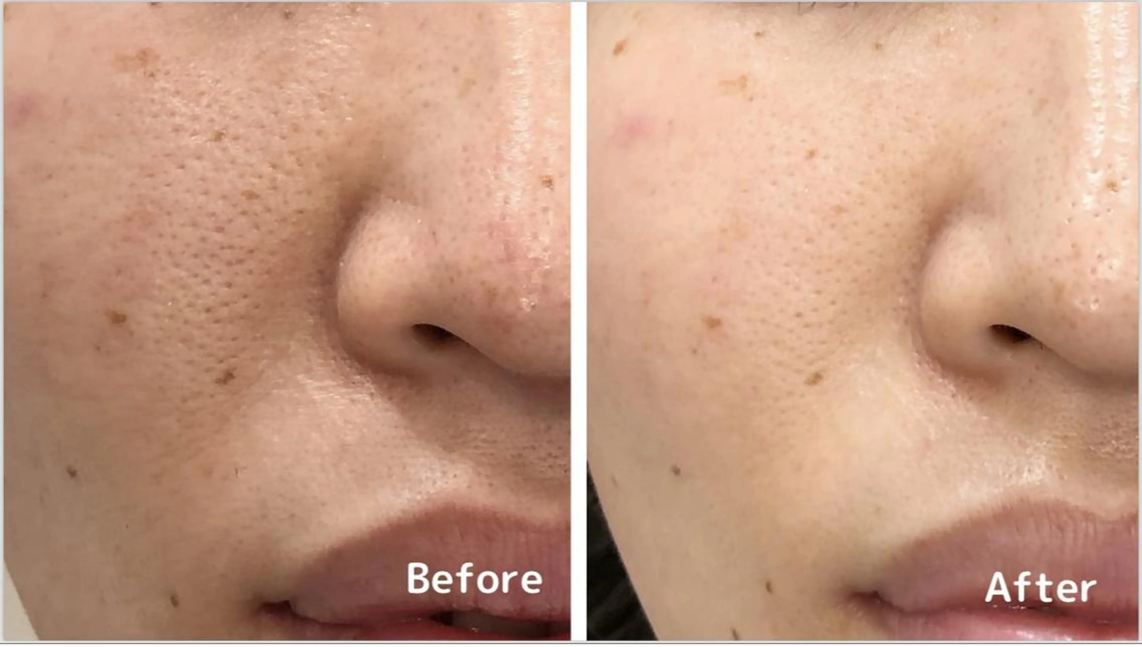 アンジェリック ビーナス　Rinonのエステ・リラクイメージ