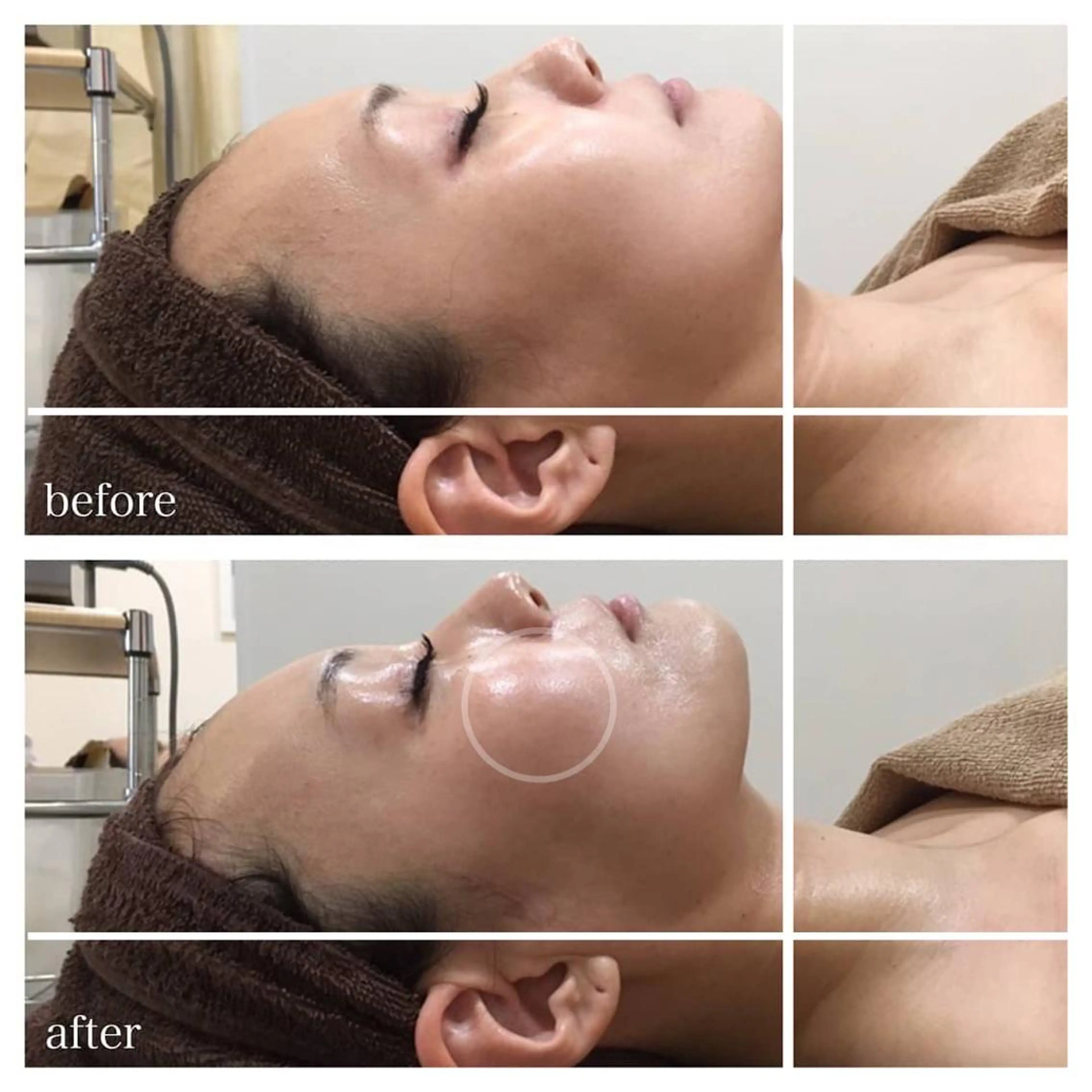 望月 はるかのエステ・リラクイメージ