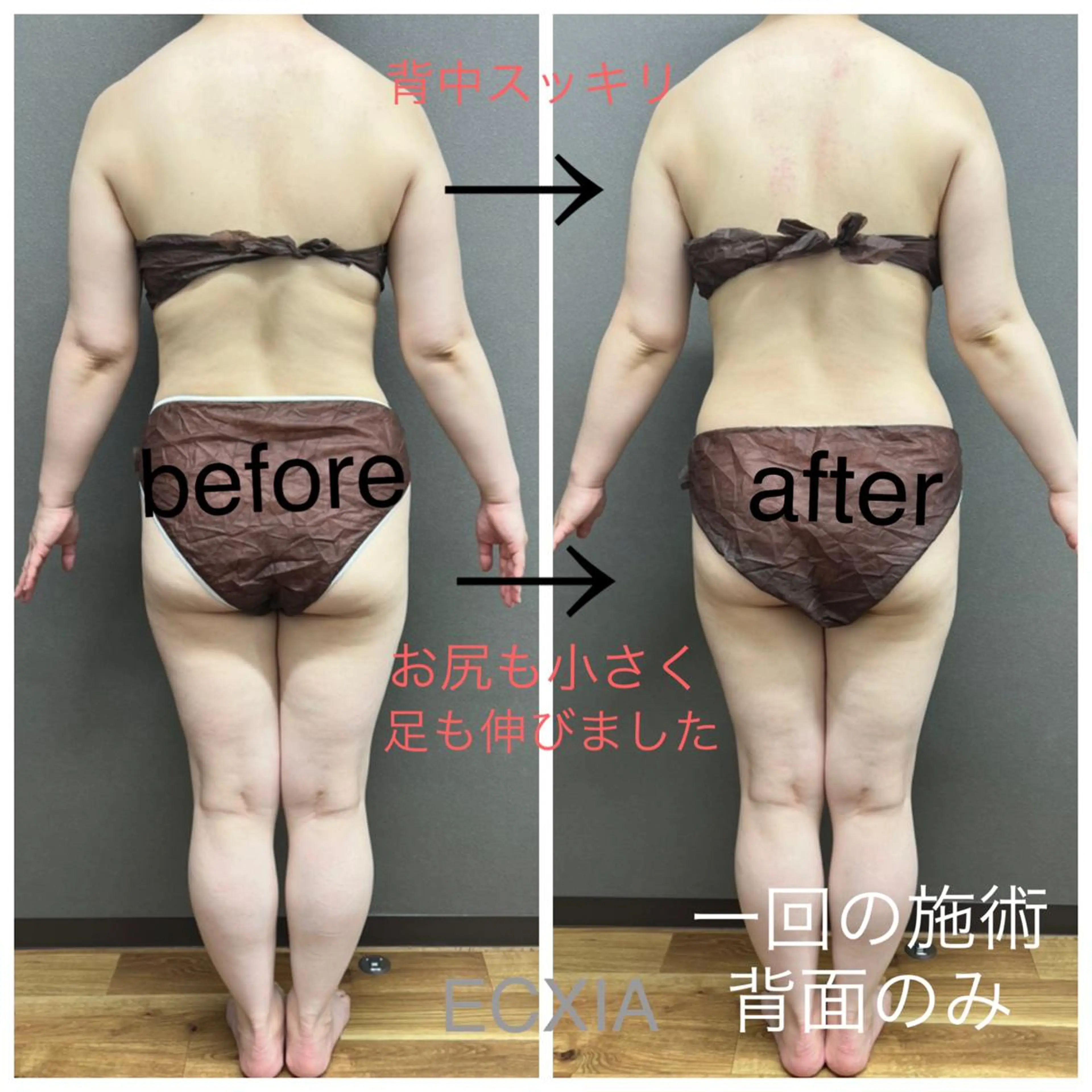 エステ リラク ECXIA 【エクシア】のエステ・リラクイメージ