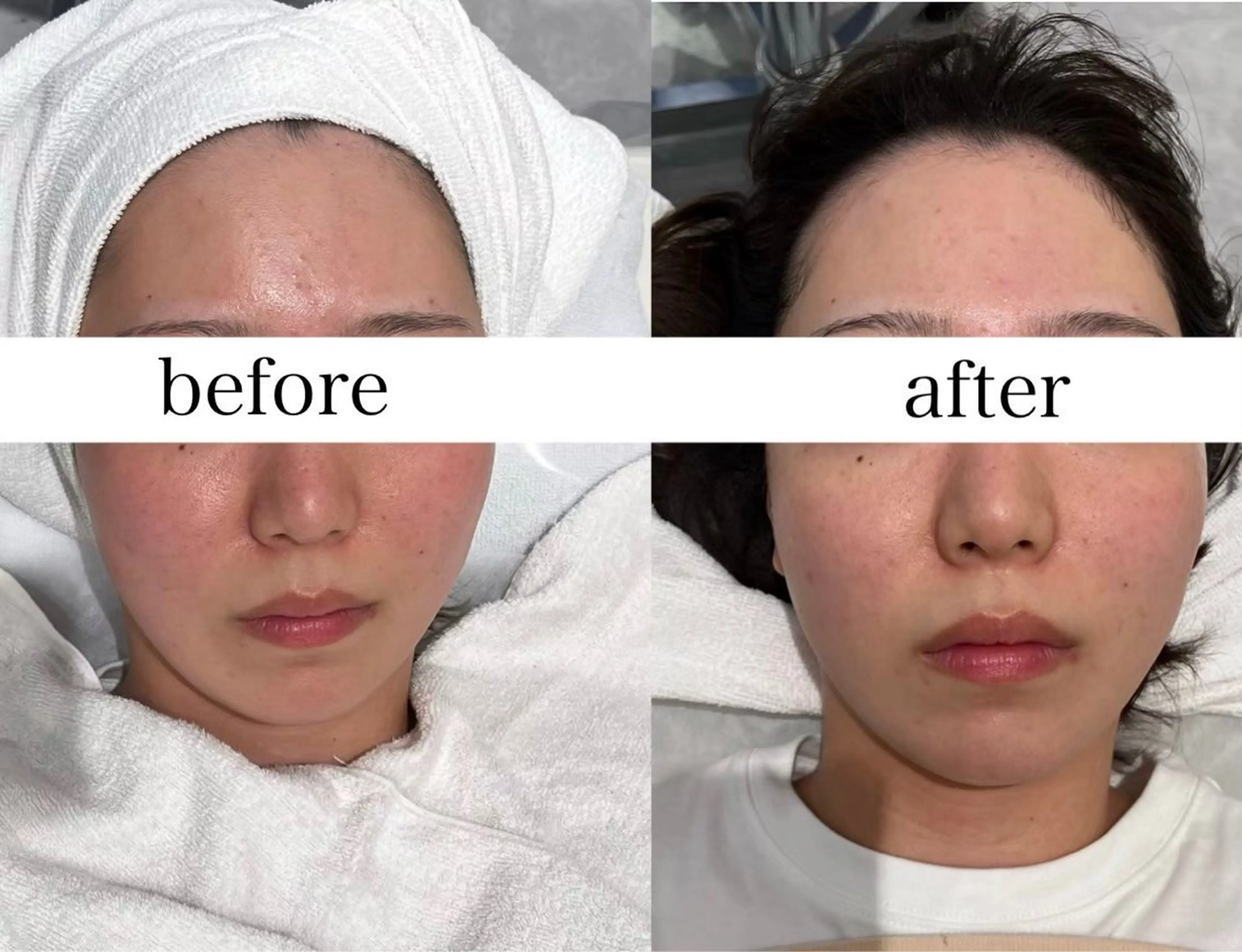 エステ FOXYLASH inoueのエステ・リラクイメージ