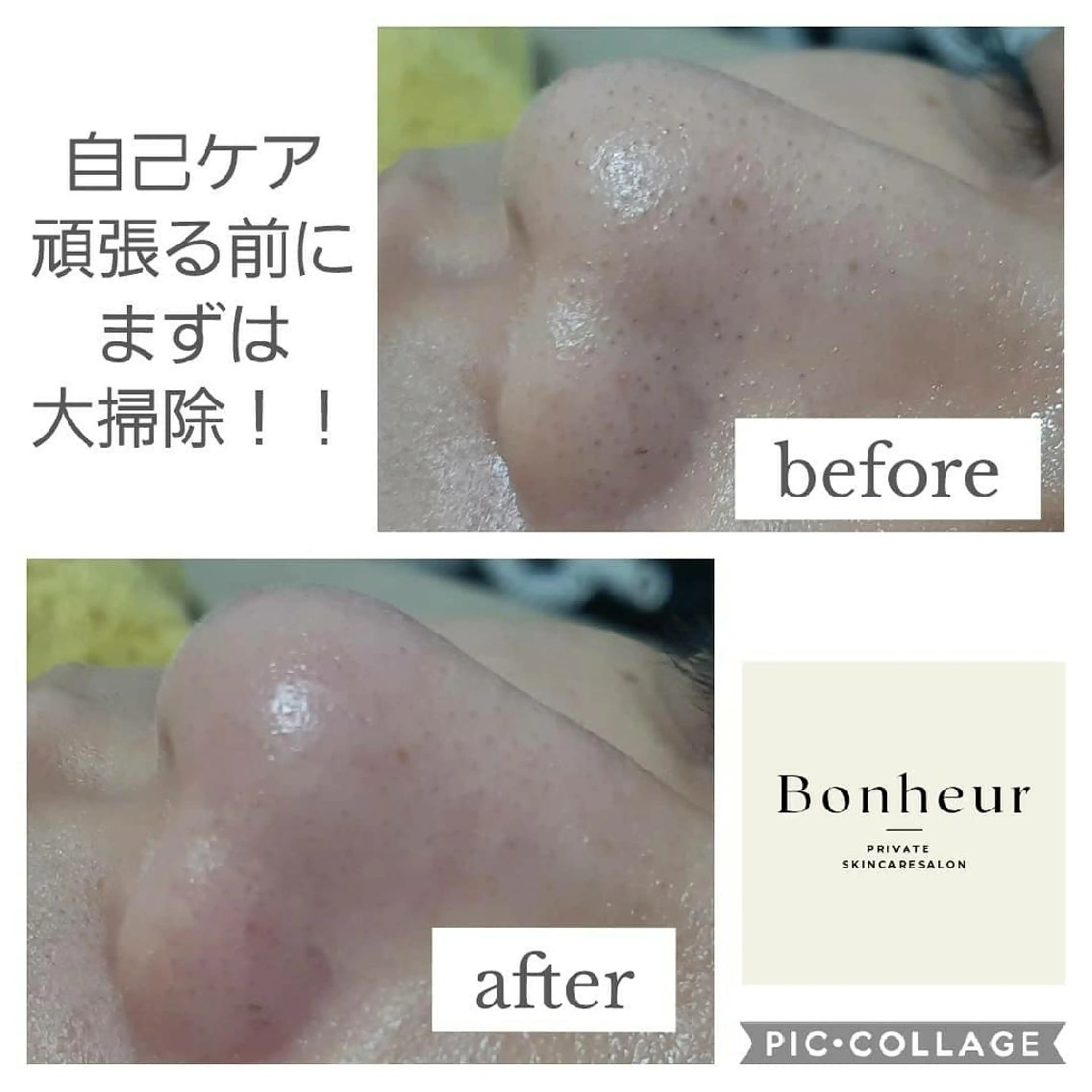 エステ 毛穴ケア・肌質改善 徳川のエステ・リラクイメージ