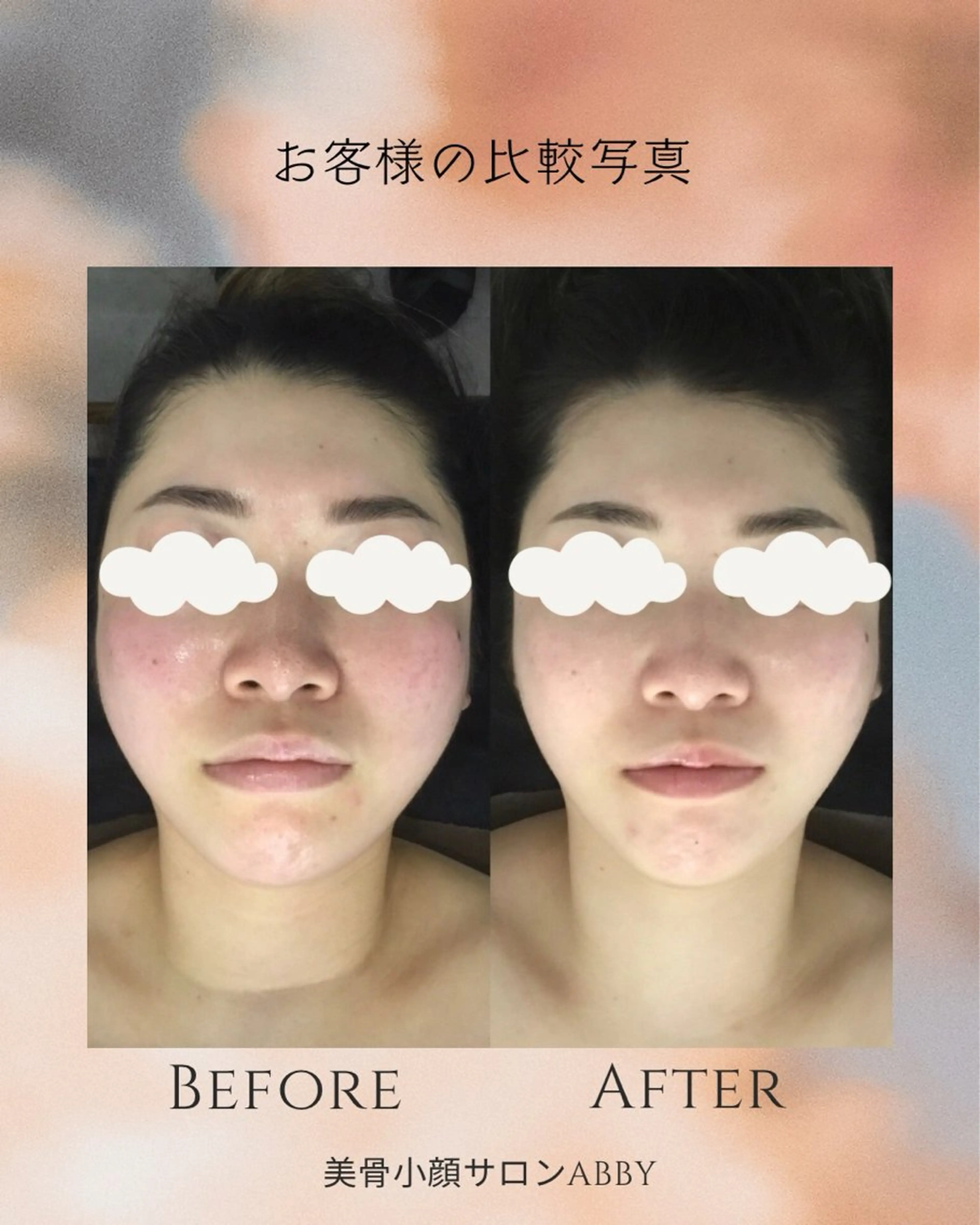 エステ リラク 小顔コルギ💎 ABBY SANOのエステ・リラクイメージ