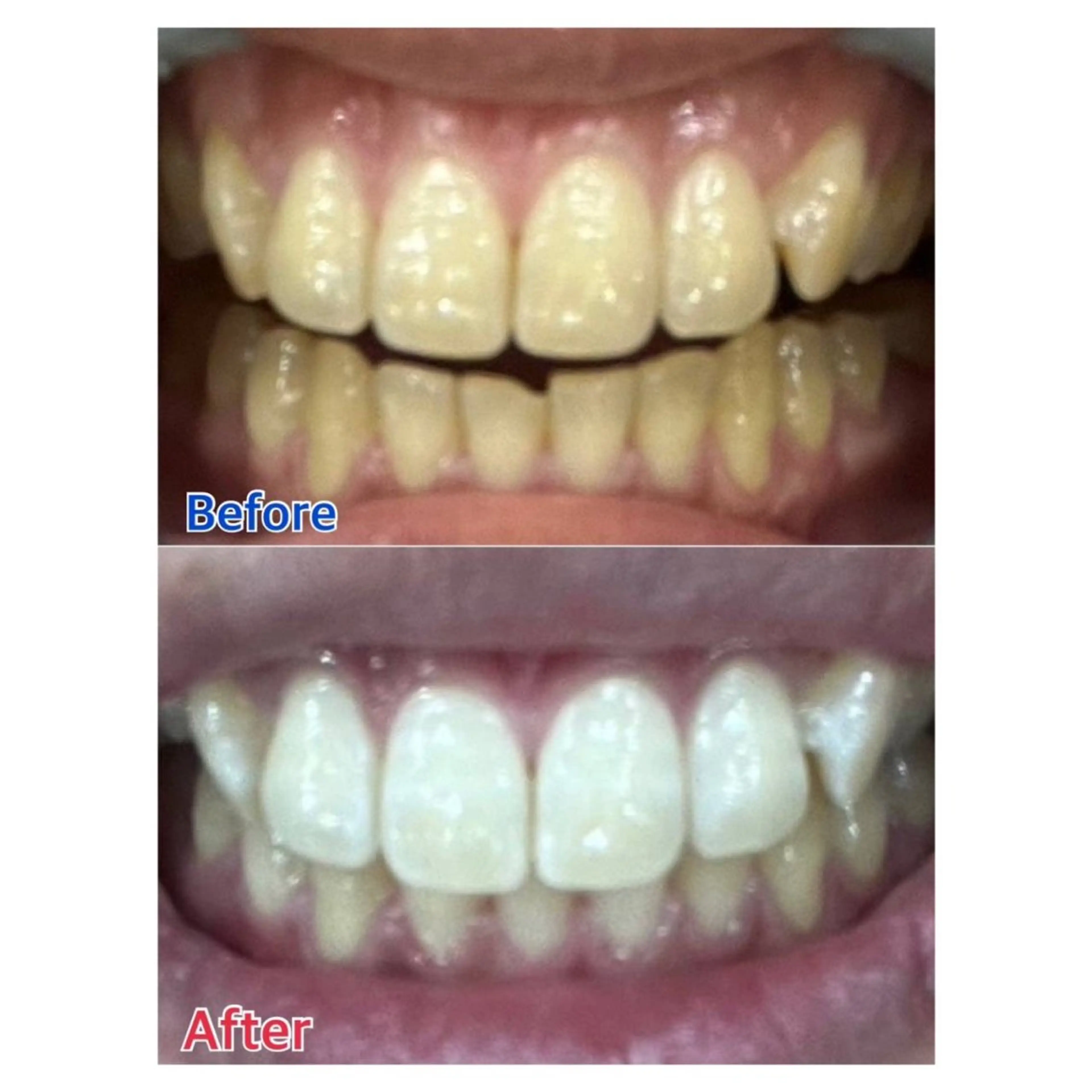 MBEAUTYSALON 千葉店・京成大久保所属・Melty 輝のその他イメージ