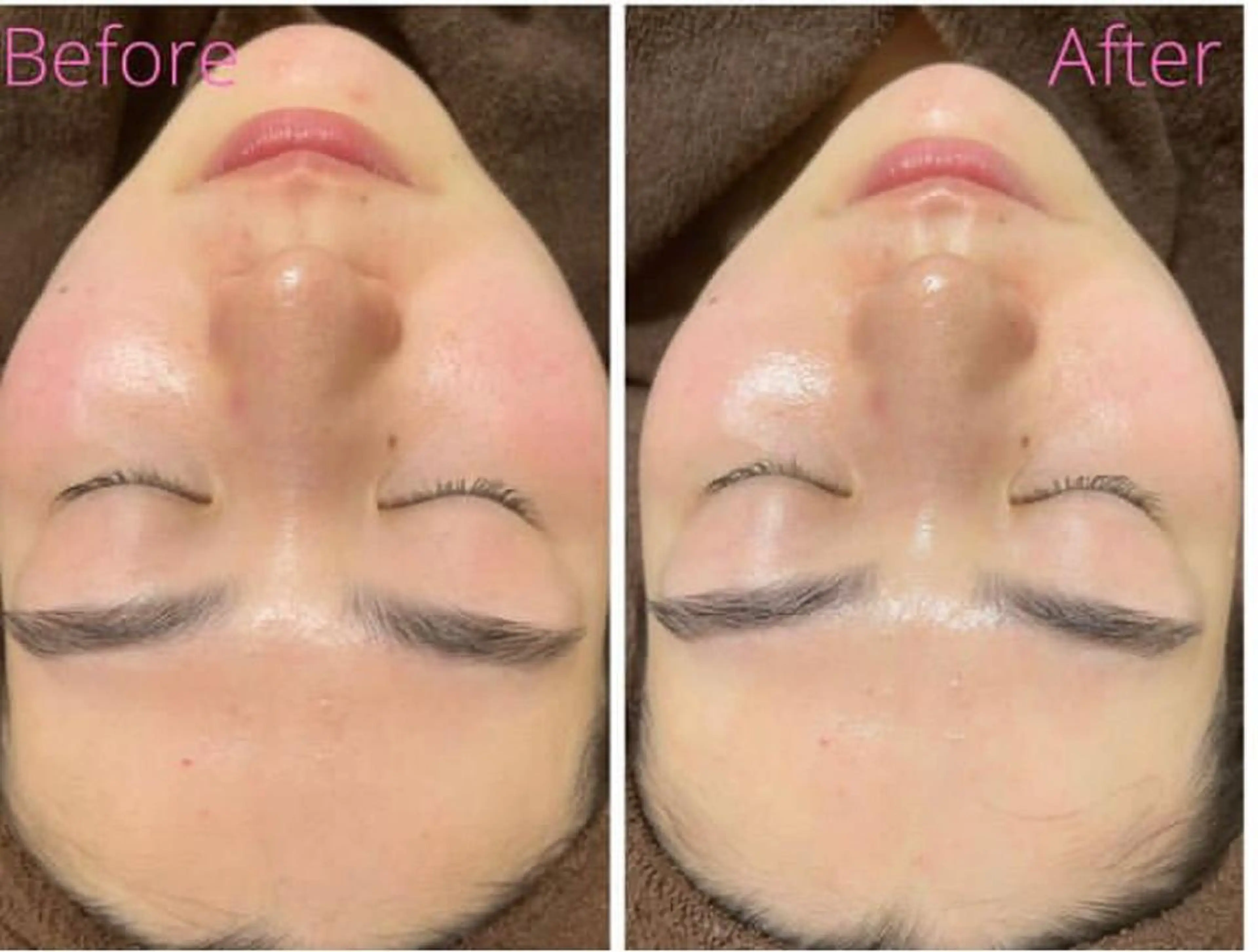 肌質改善サロン La Divinaのエステ・リラクイメージ