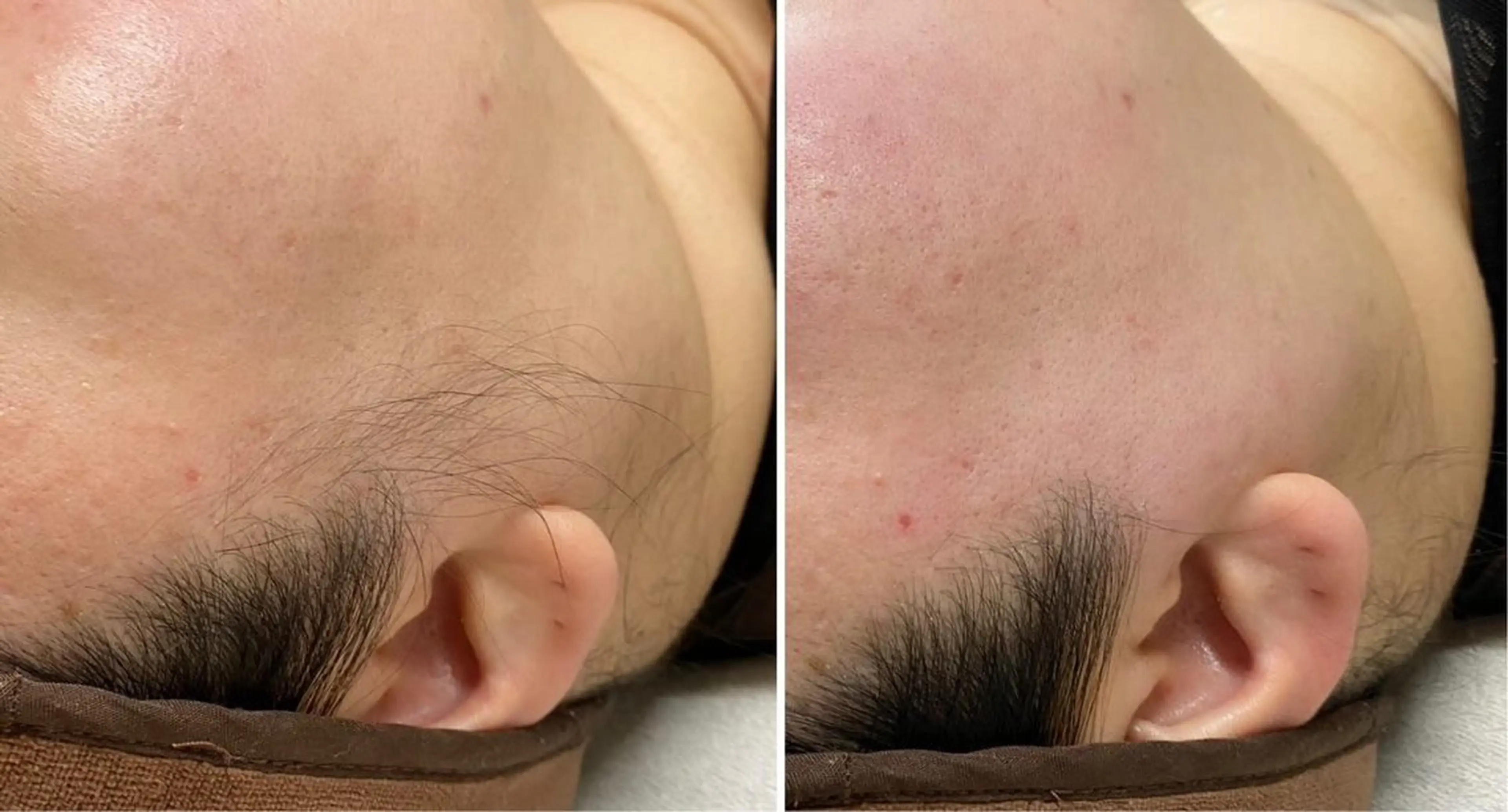 脱毛 padma シュガーリングのエステ・リラクイメージ