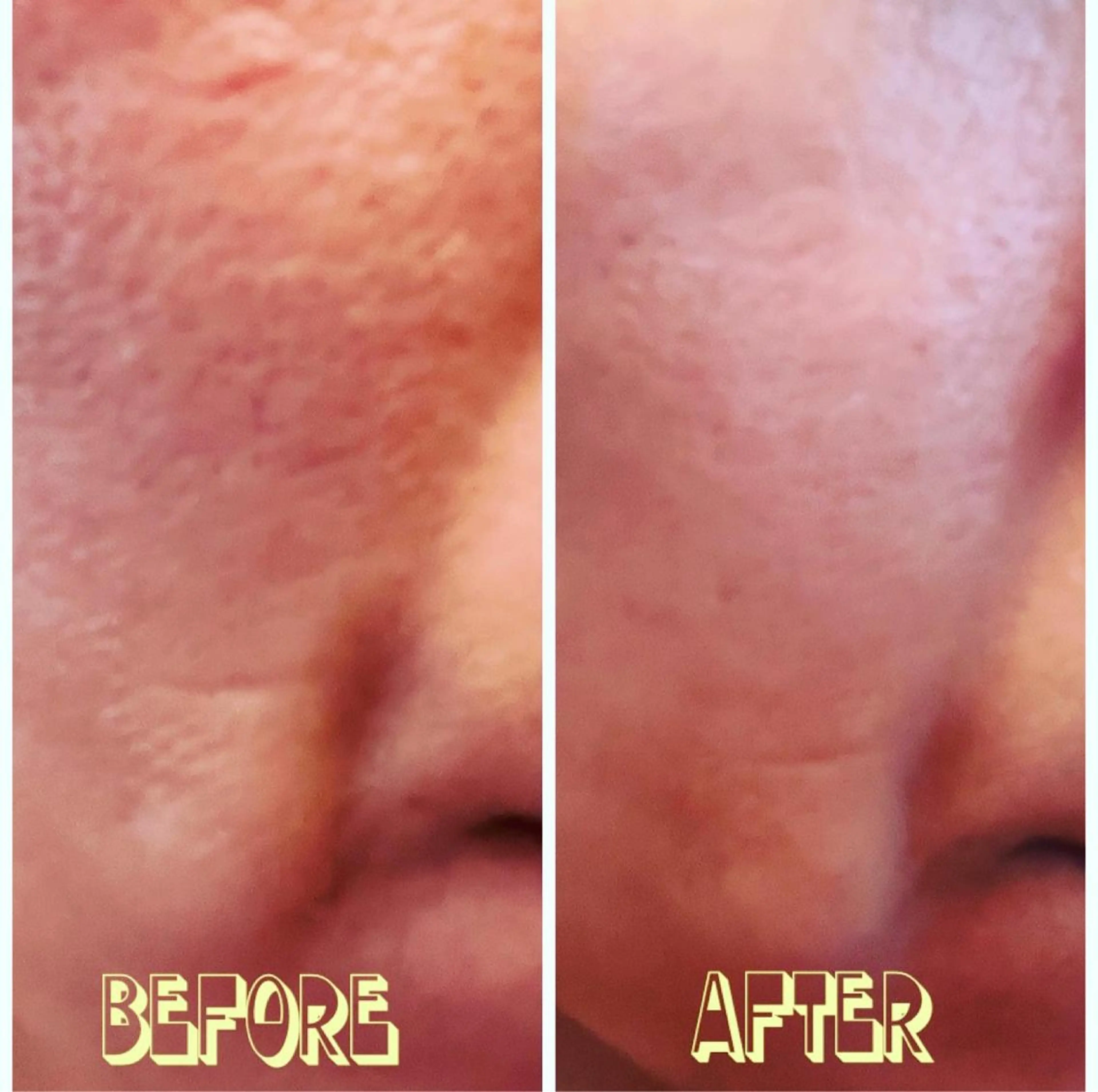 Del’m白根所属・八木原公江 DeI'm白根のエステ・リラクイメージ