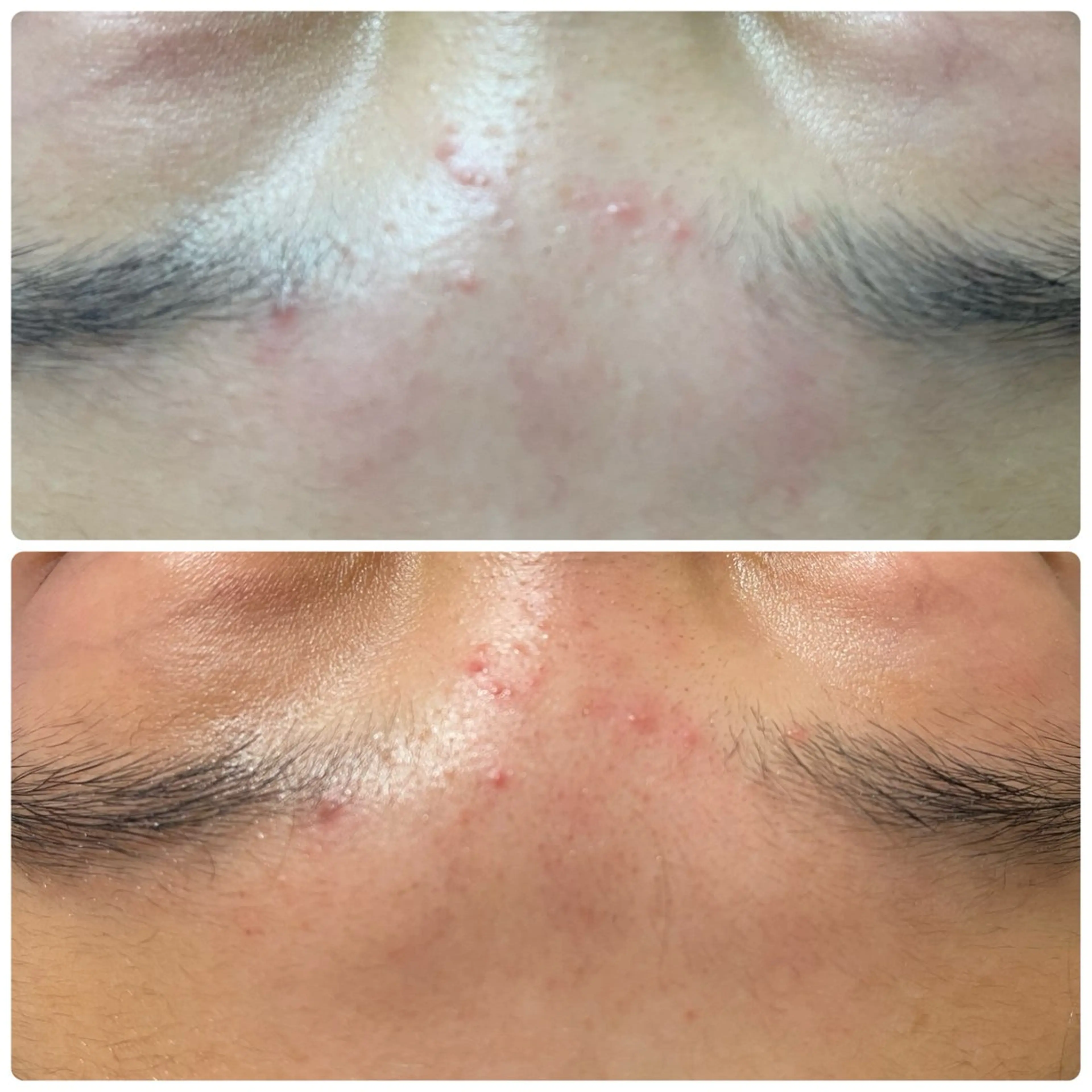 🔰 新米ネイリストのネイルデザイン