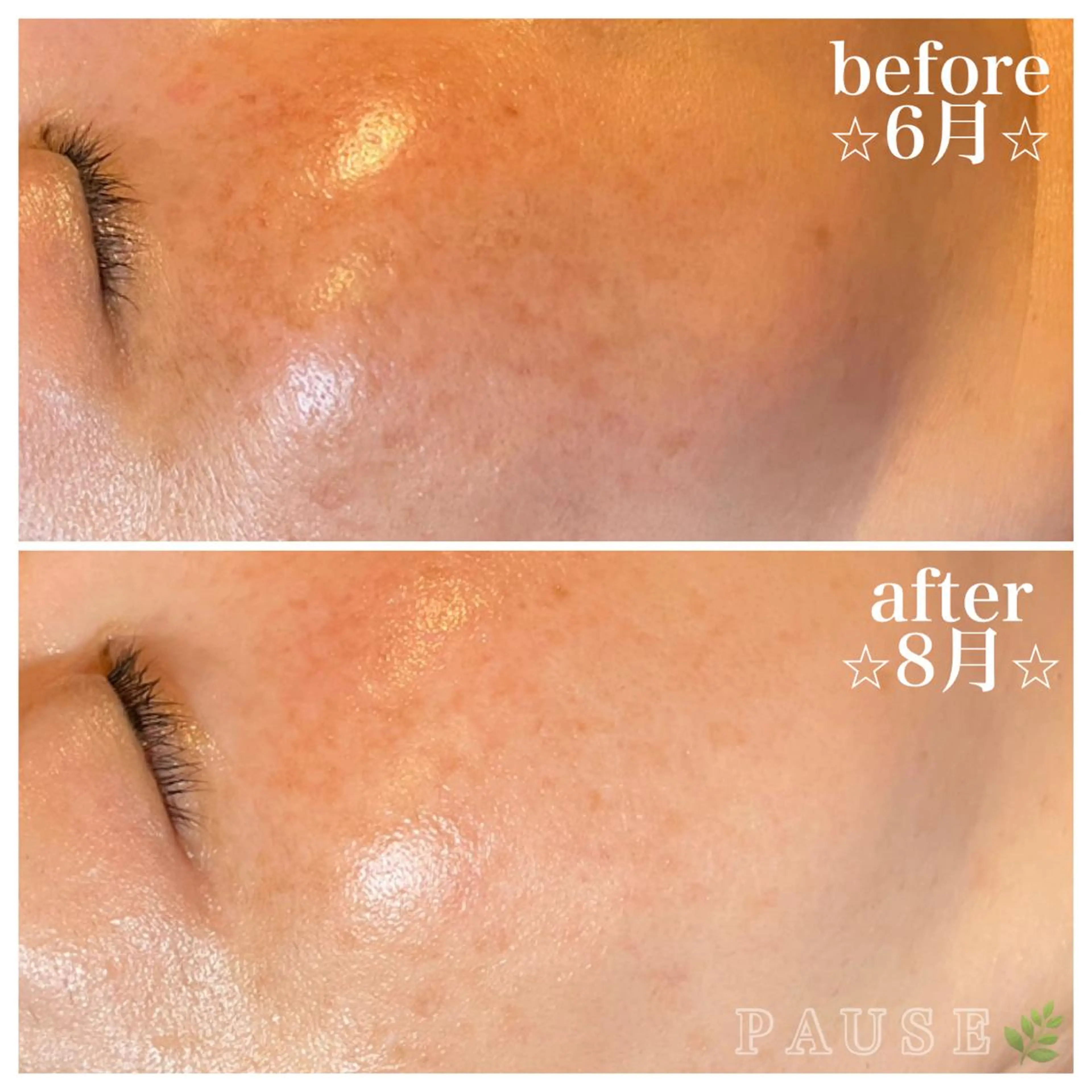 エステ 浜野 恵美のエステ・リラクイメージ